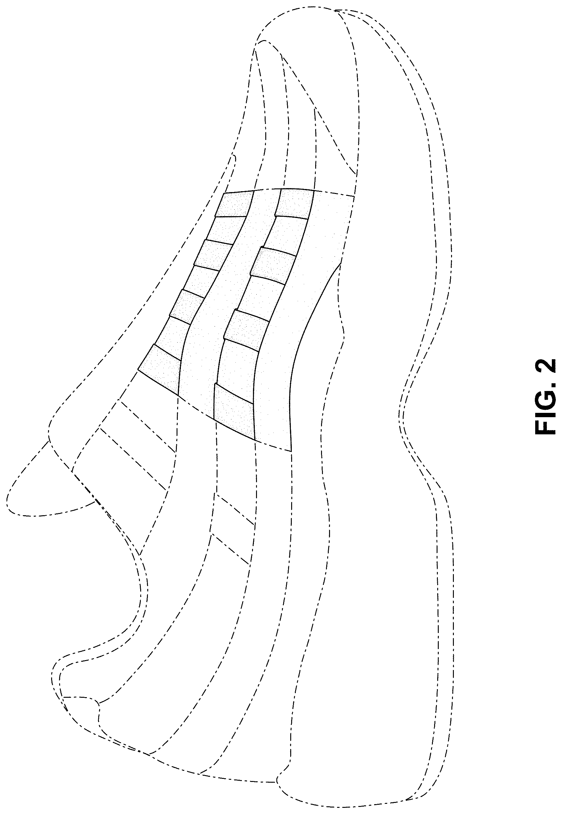 Patent USD1000815 Figure 2 – Shoe