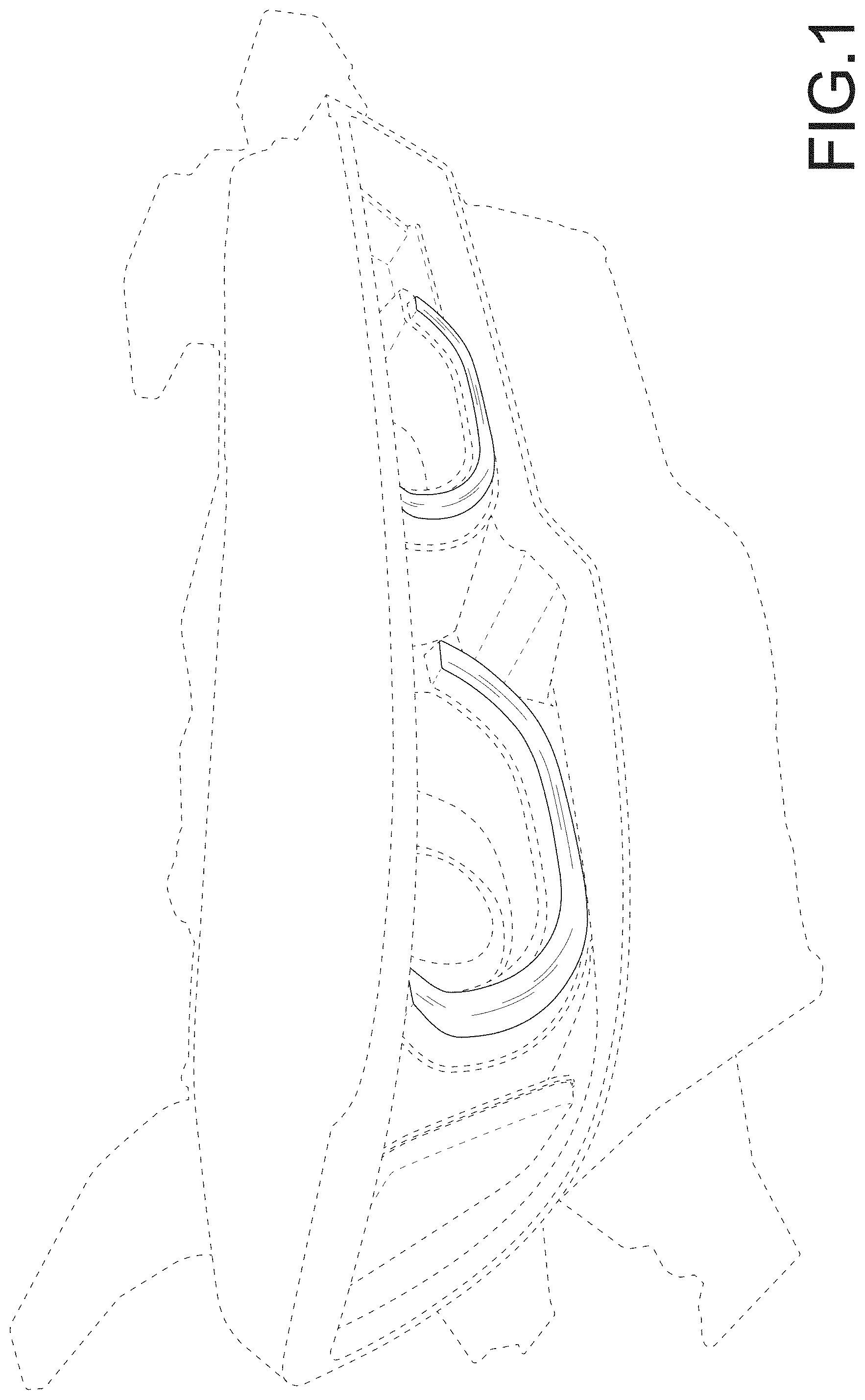 Patent USD1001323 Figure 1 – Headlight for a motor vehicle
