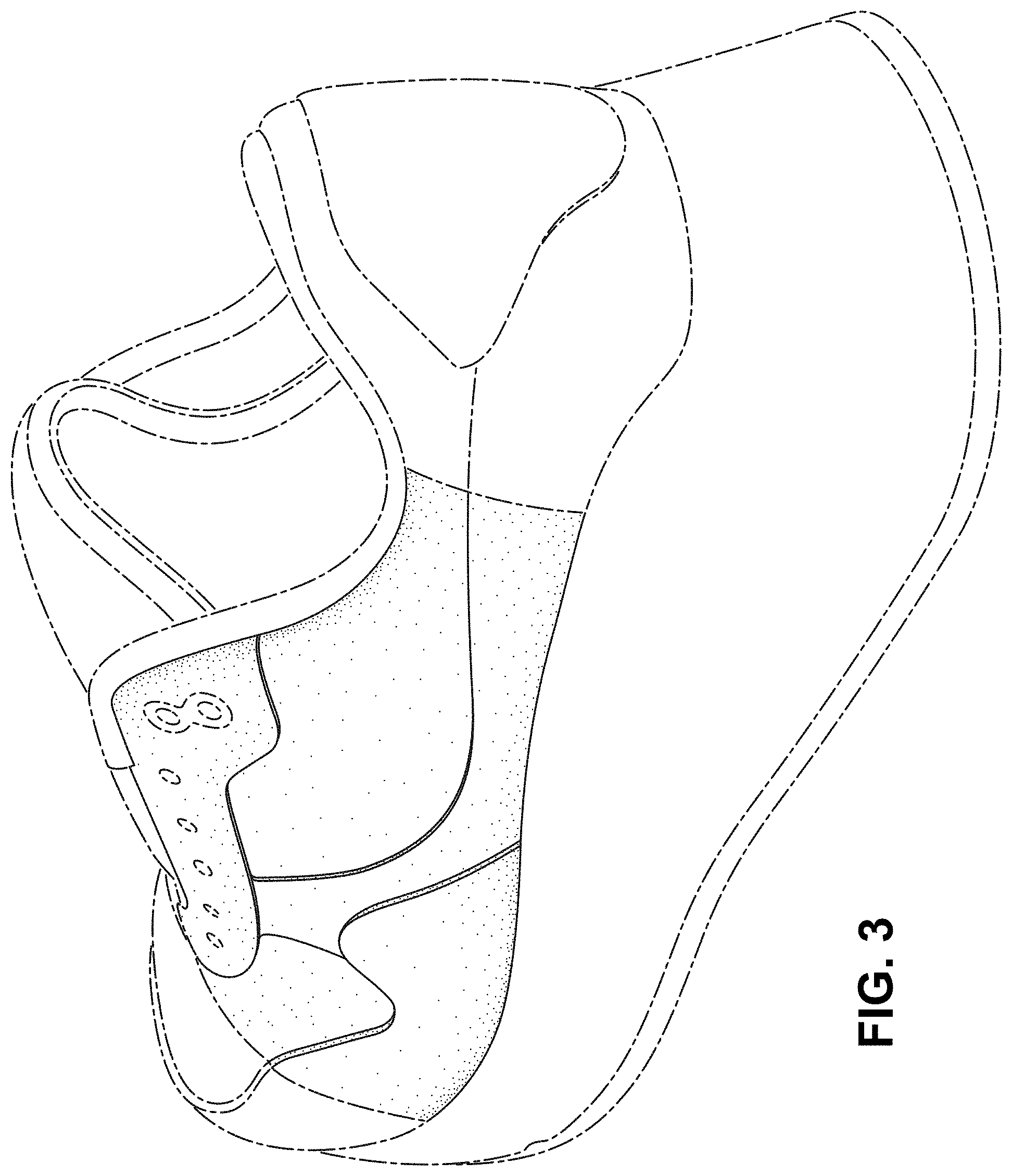 Patent USD1001427 Figure 3 – Shoe