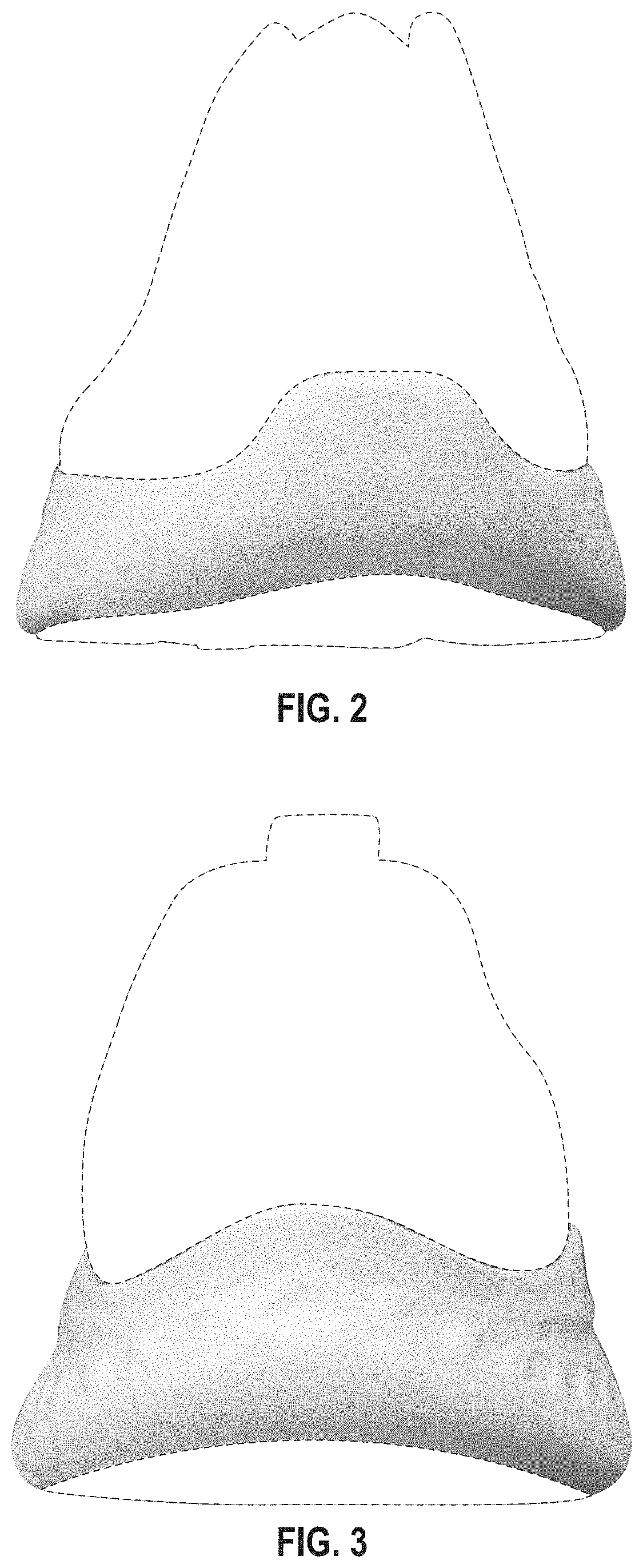 Patent USD1001439 Figure 2 – Shoe midsole periphery