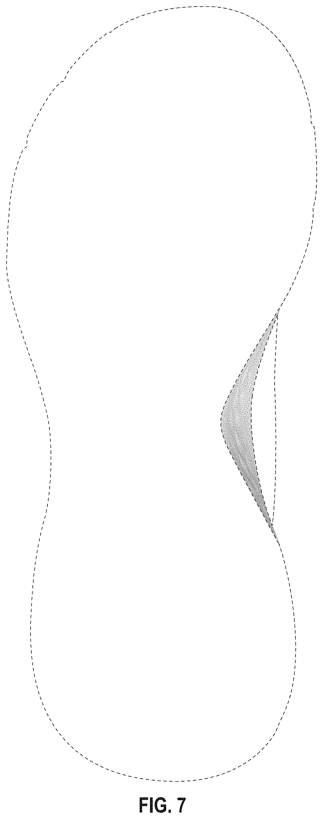 Patent USD1001439 Figure 6 – Shoe midsole periphery