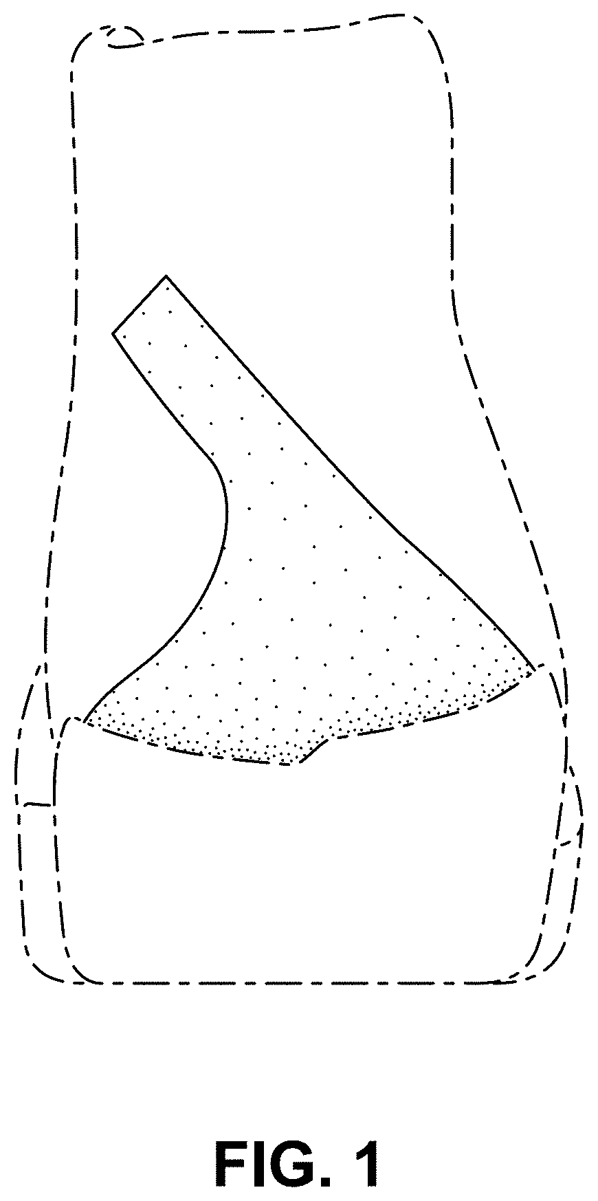 Patent USD1001440 Figure 1 – Shoe