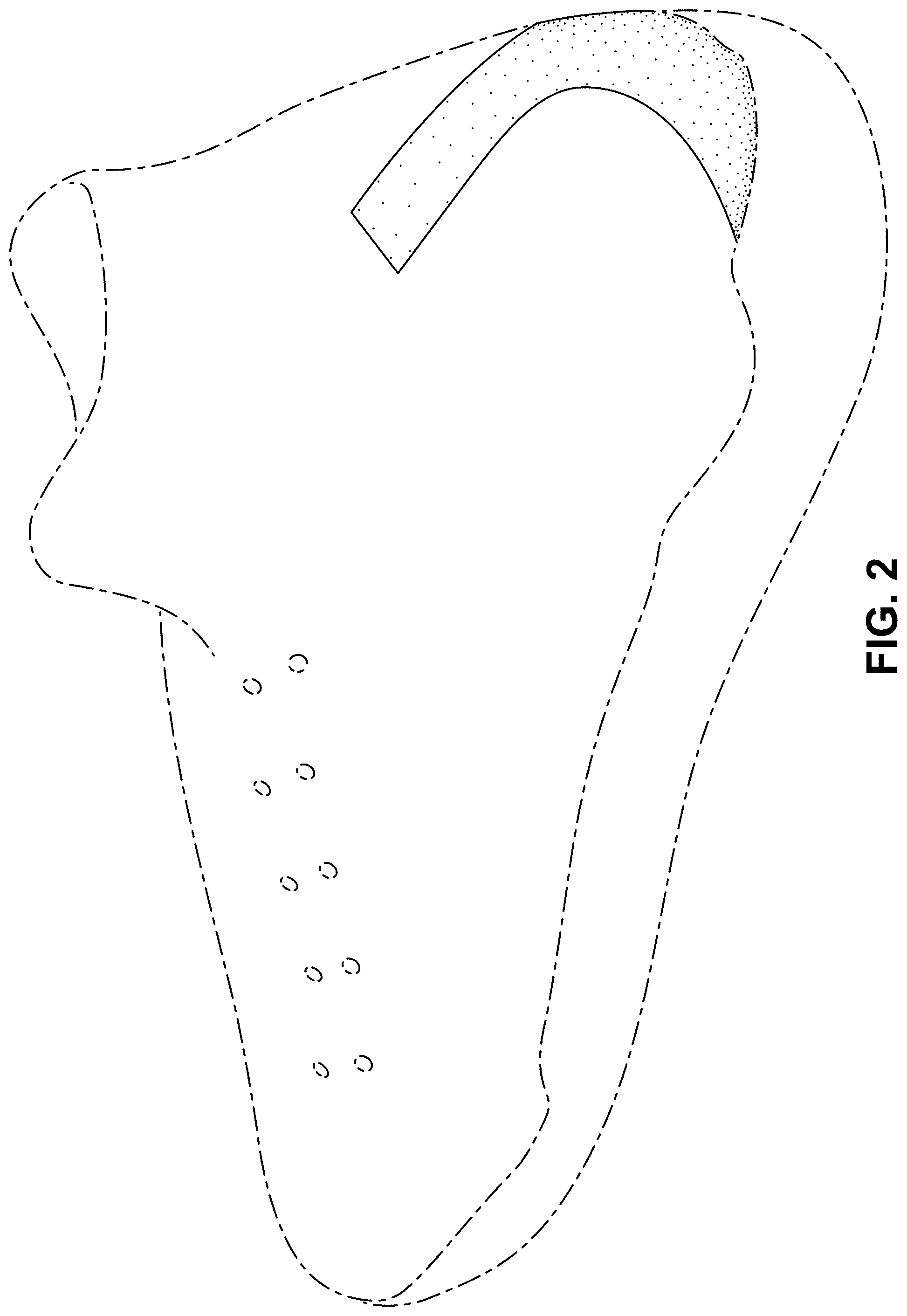 Patent USD1001440 Figure 2 – Shoe