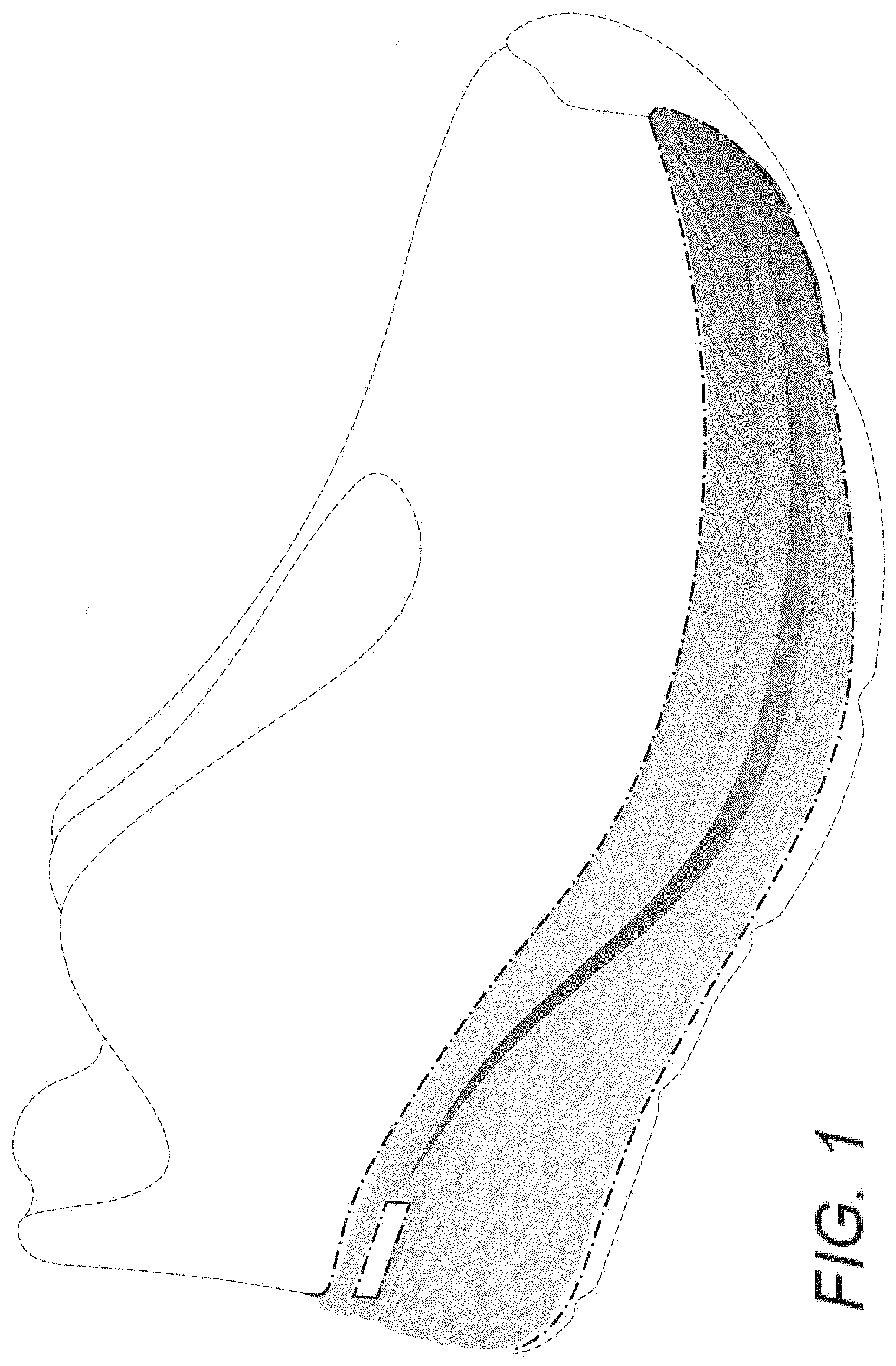 Patent USD1001441 Figure 1 – Shoe midsole periphery