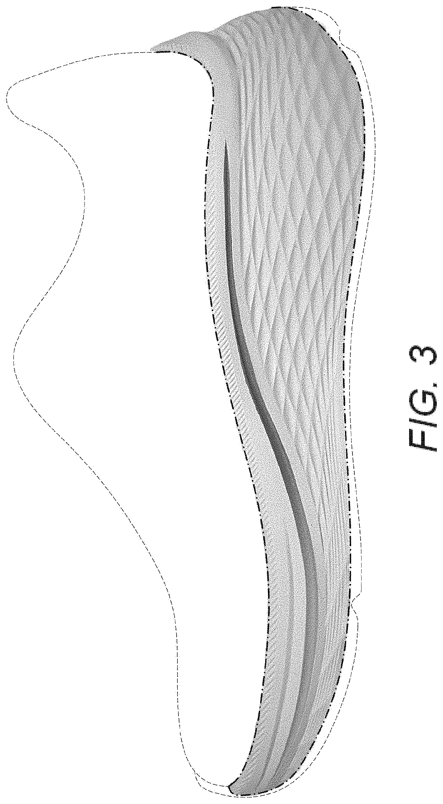 Patent USD1001441 Figure 3 – Shoe midsole periphery