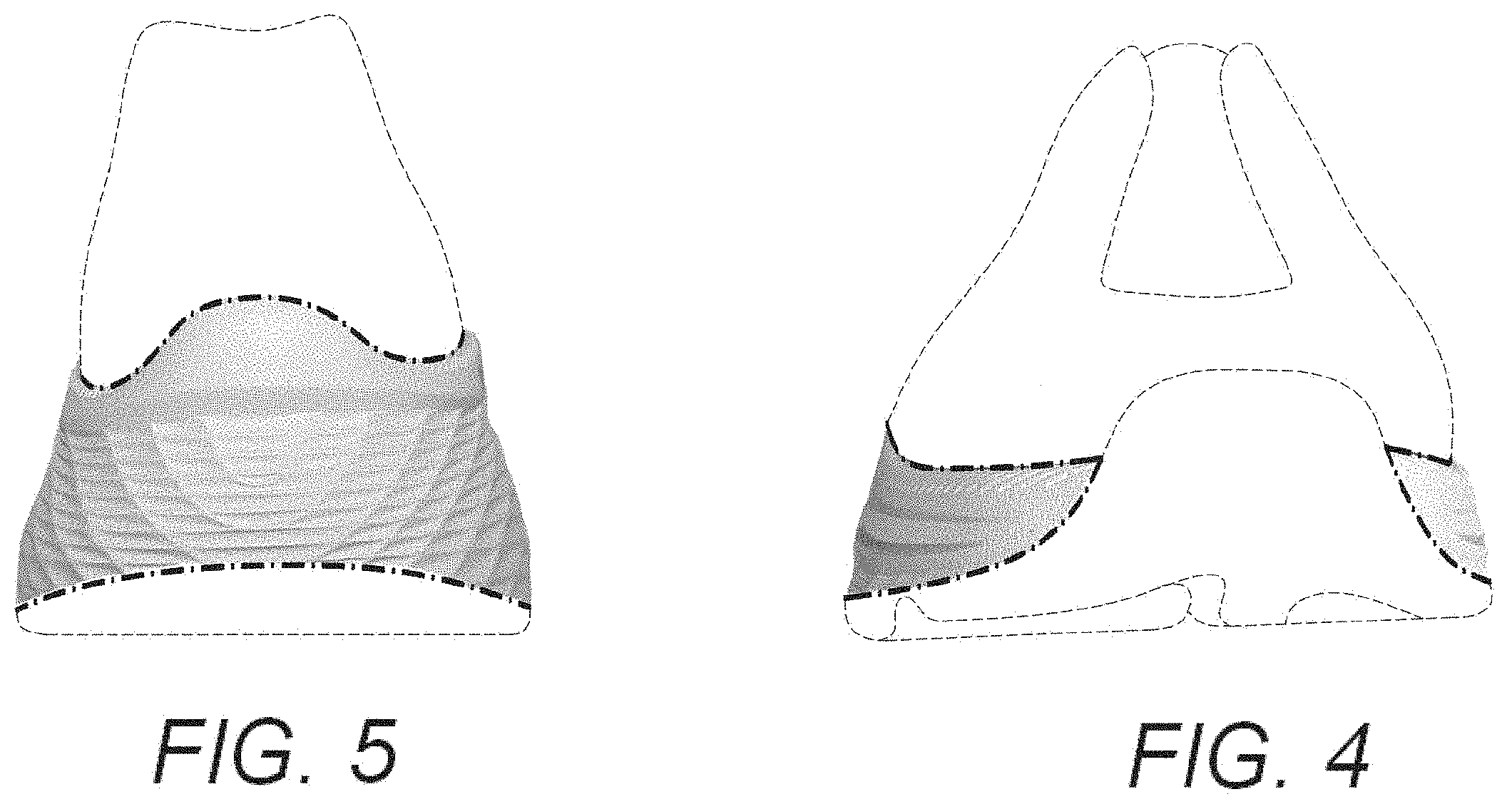 Patent USD1001441 Figure 4 – Shoe midsole periphery