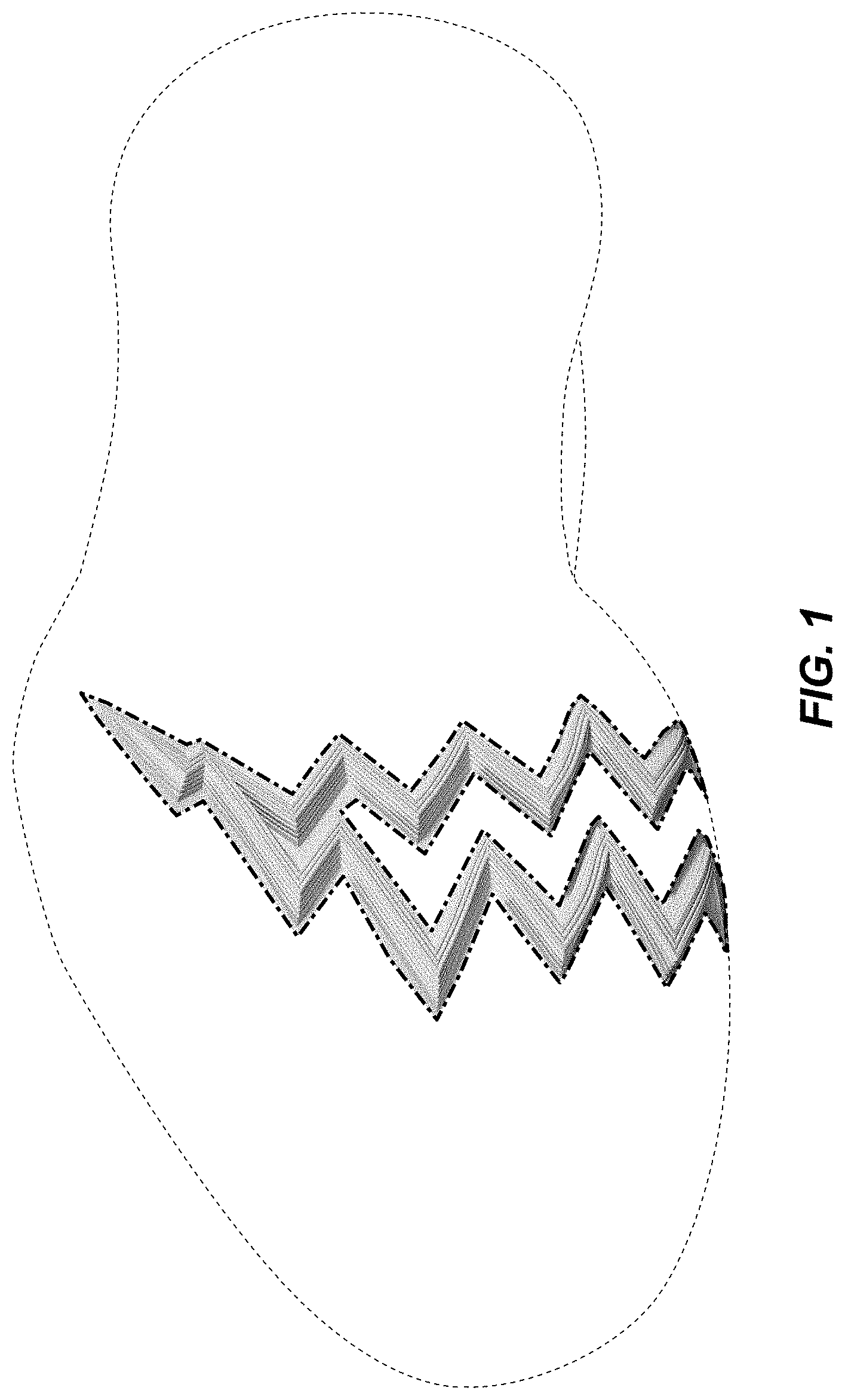 Patent USD1001448 Figure 1 – Shoe