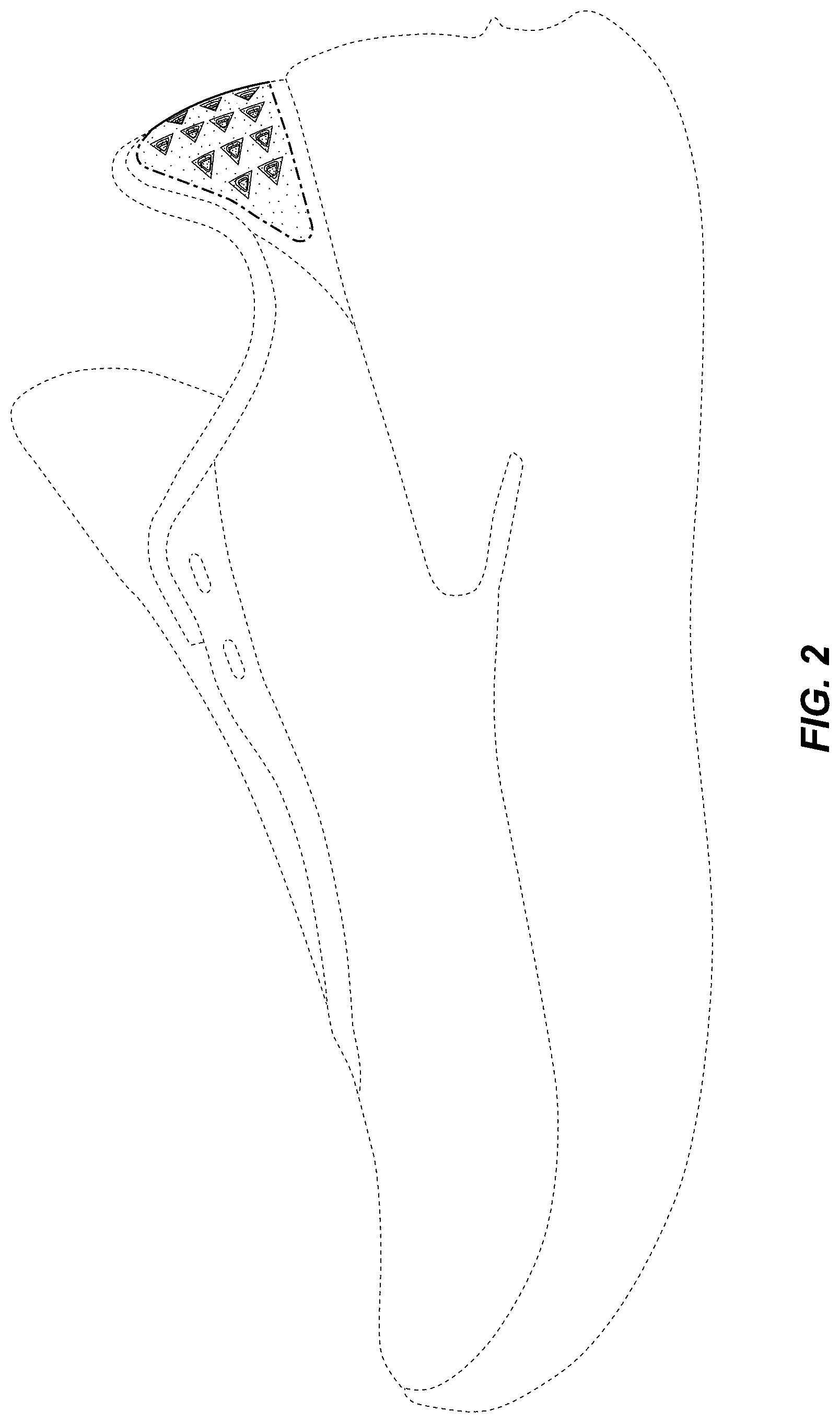 Patent USD1001463 Figure 2 – Shoe