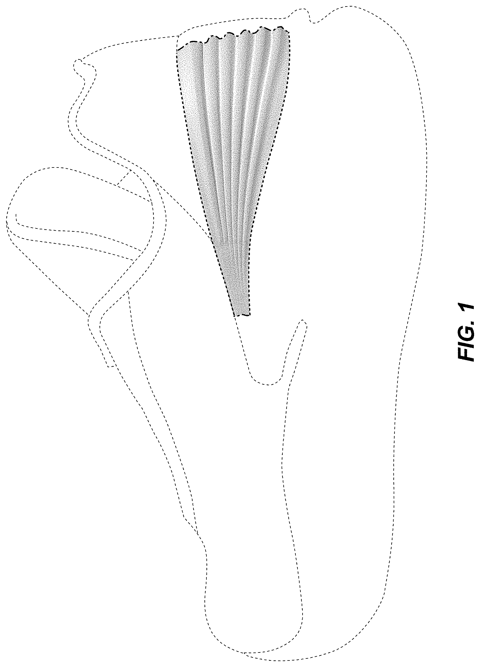 Patent USD1001464 Figure 1 – Shoe