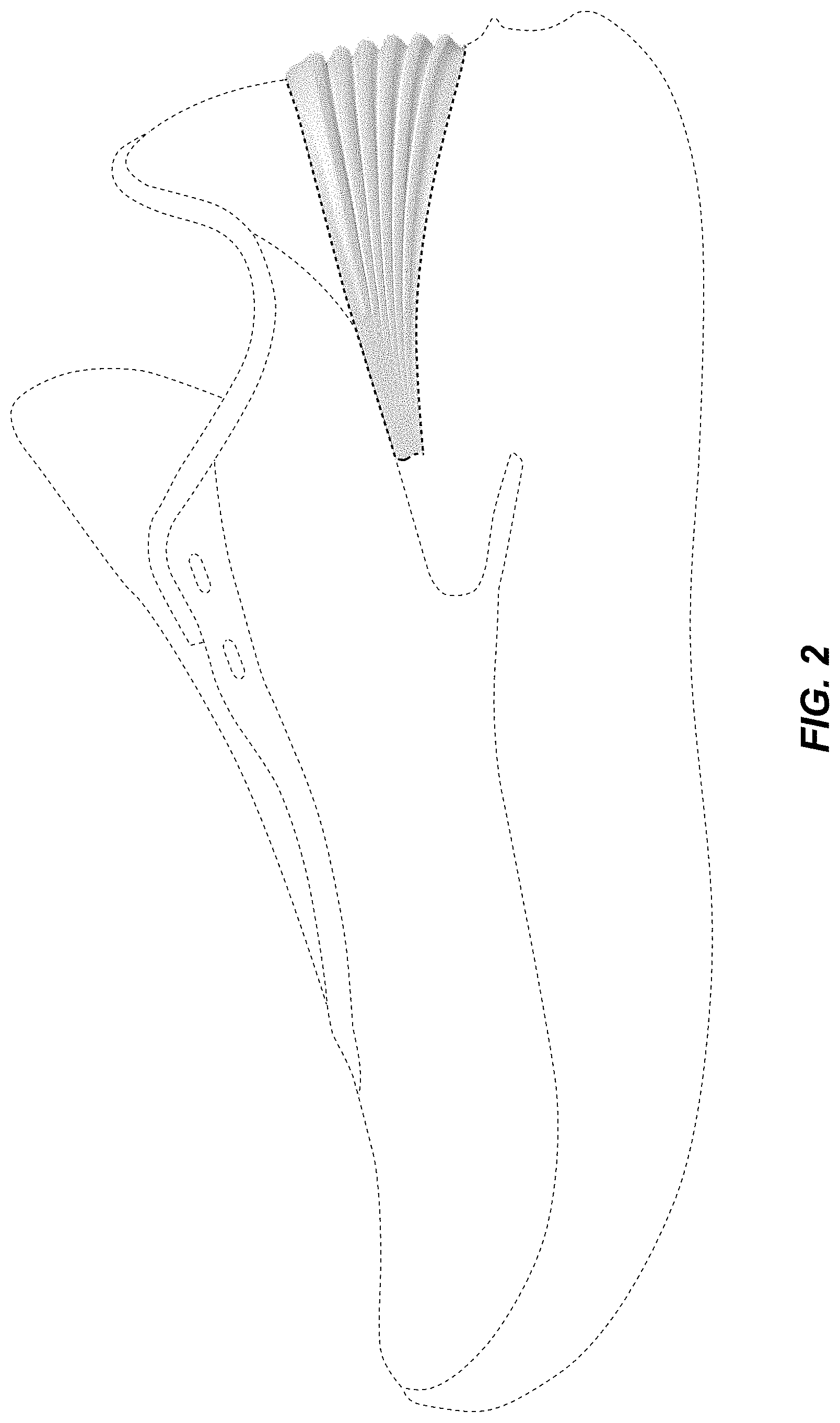 Patent USD1001464 Figure 2 – Shoe