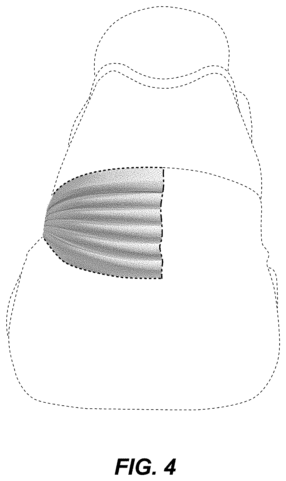 Patent USD1001464 Figure 4 – Shoe