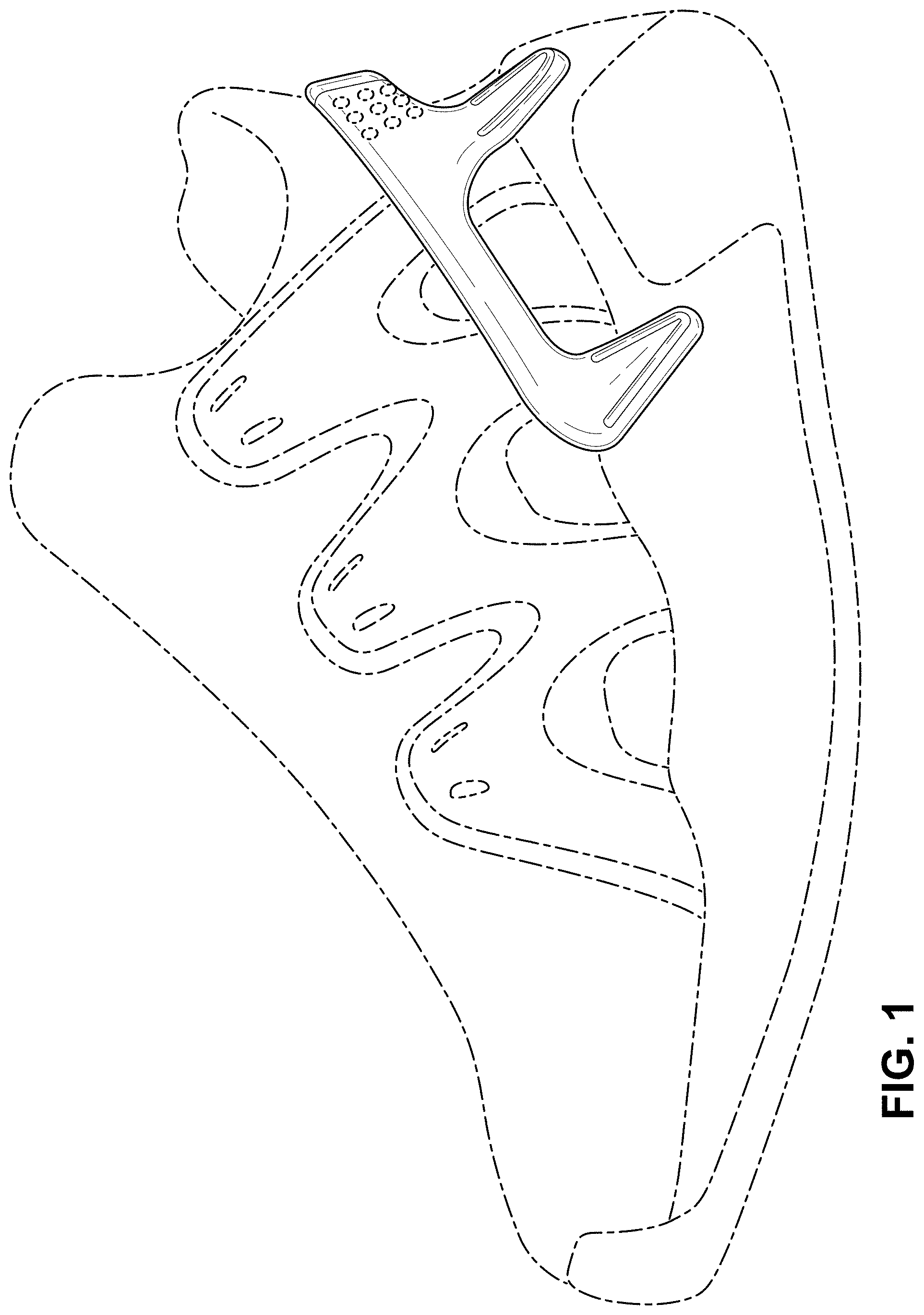Patent USD1001473 Figure 1 – Shoe