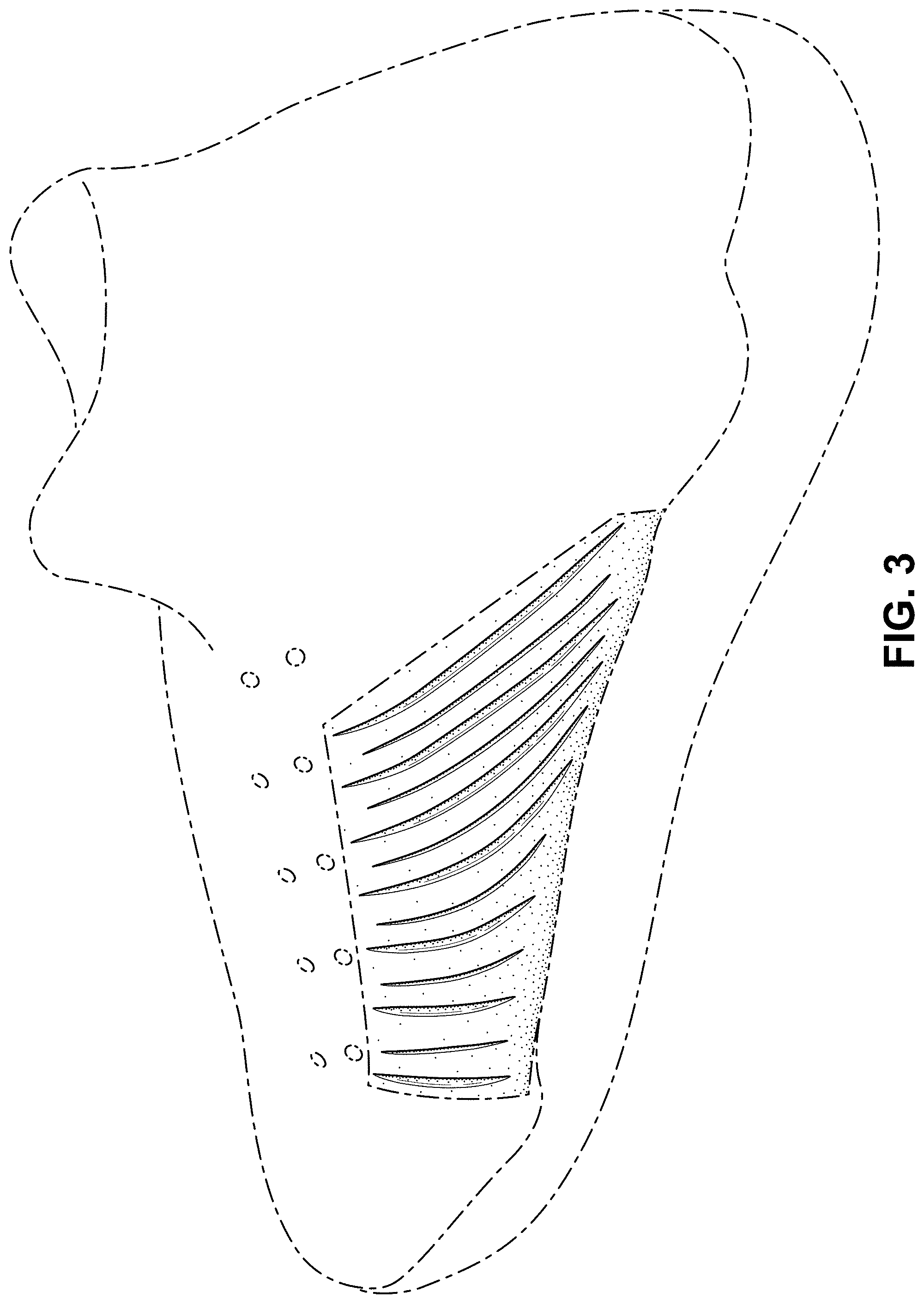 Patent USD1001475 Figure 3 – Shoe