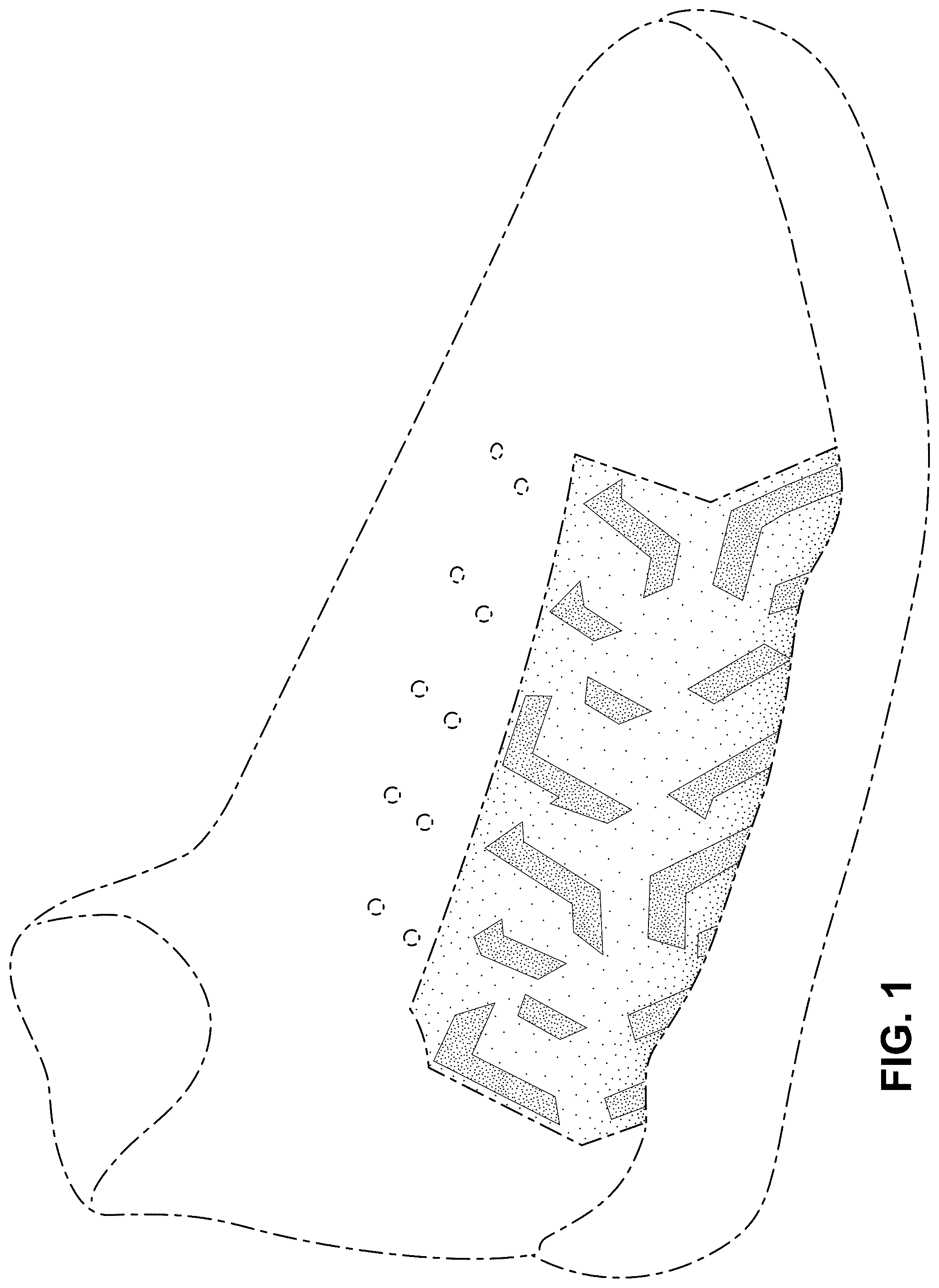 Patent USD1001476 Figure 1 – Shoe