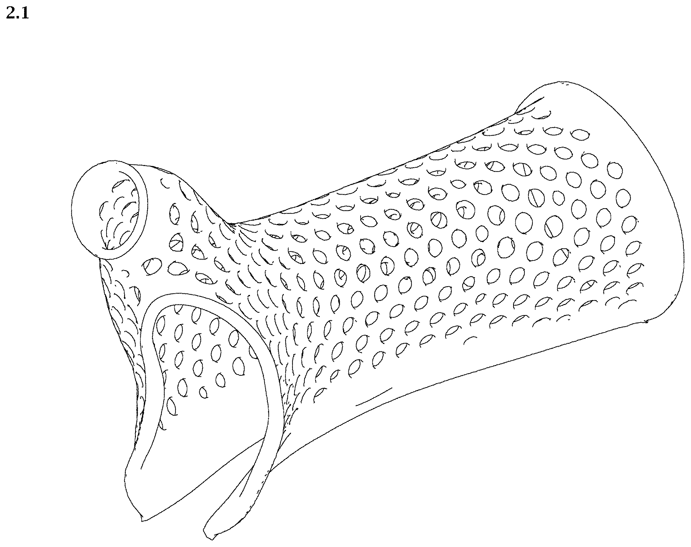 Patent USD1002021 Figure 1 – Wrist and thumb splint