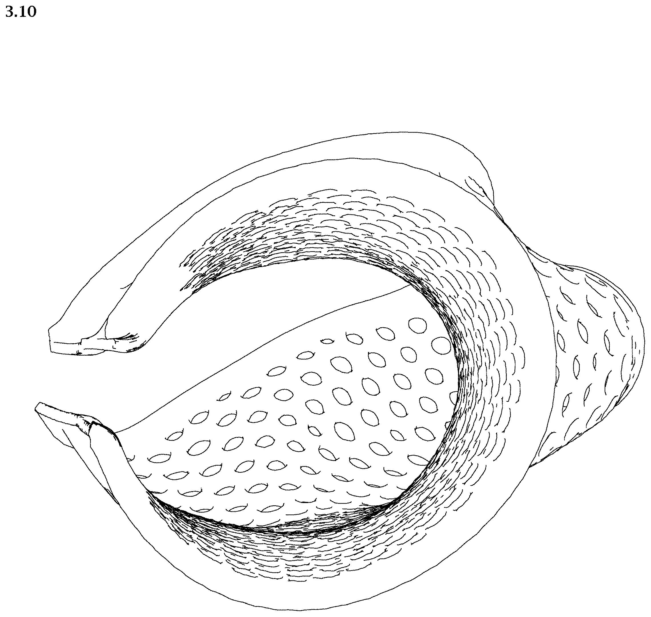 Patent USD1002021 Figure 20 – Wrist and thumb splint