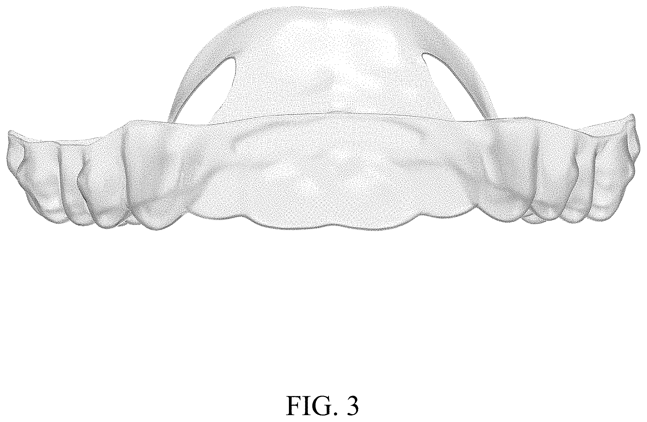 Patent USD1002112 Figure 3 – Dental appliance