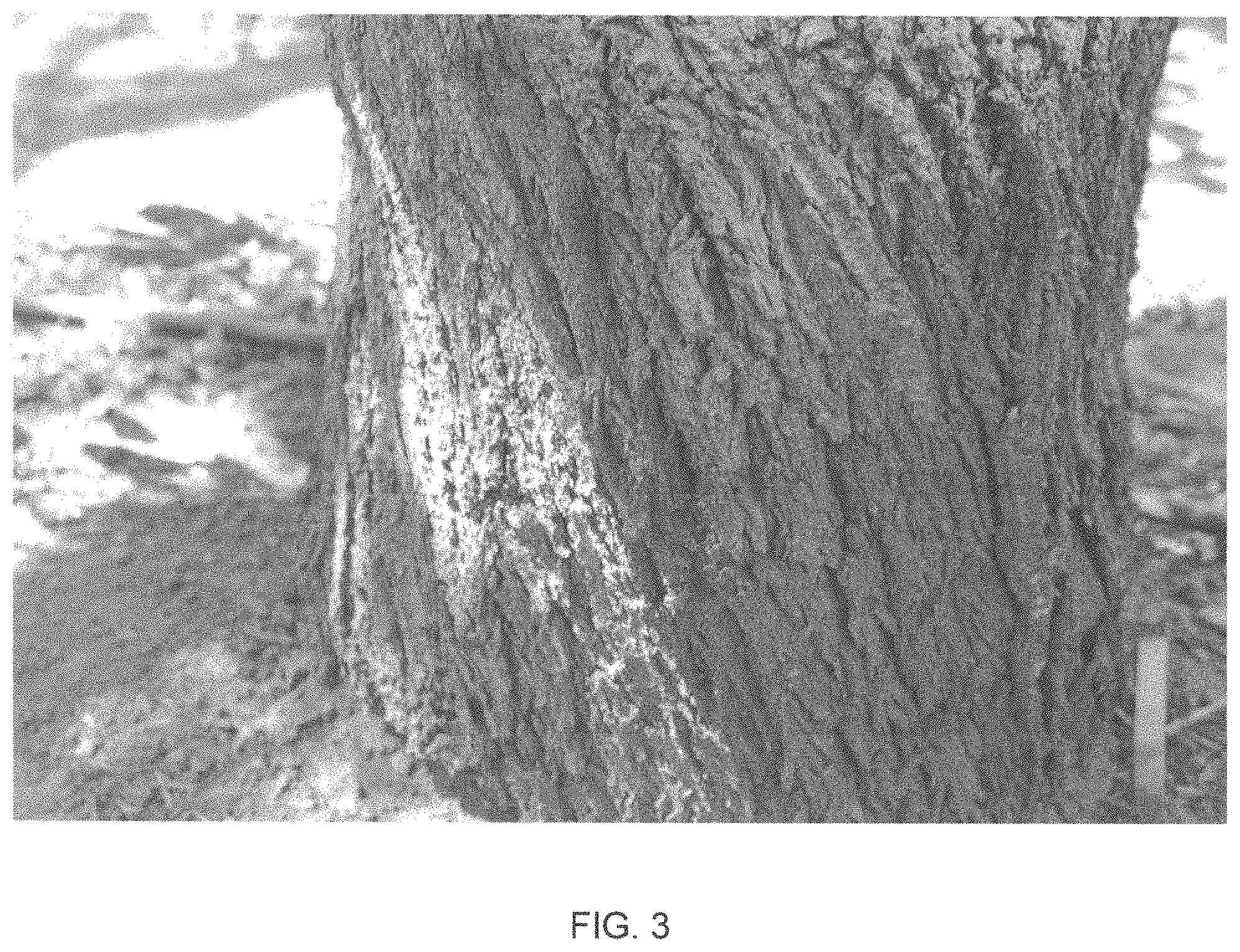 Patent USPP035421 Figure 3 – Almond tree named ‘PY1’