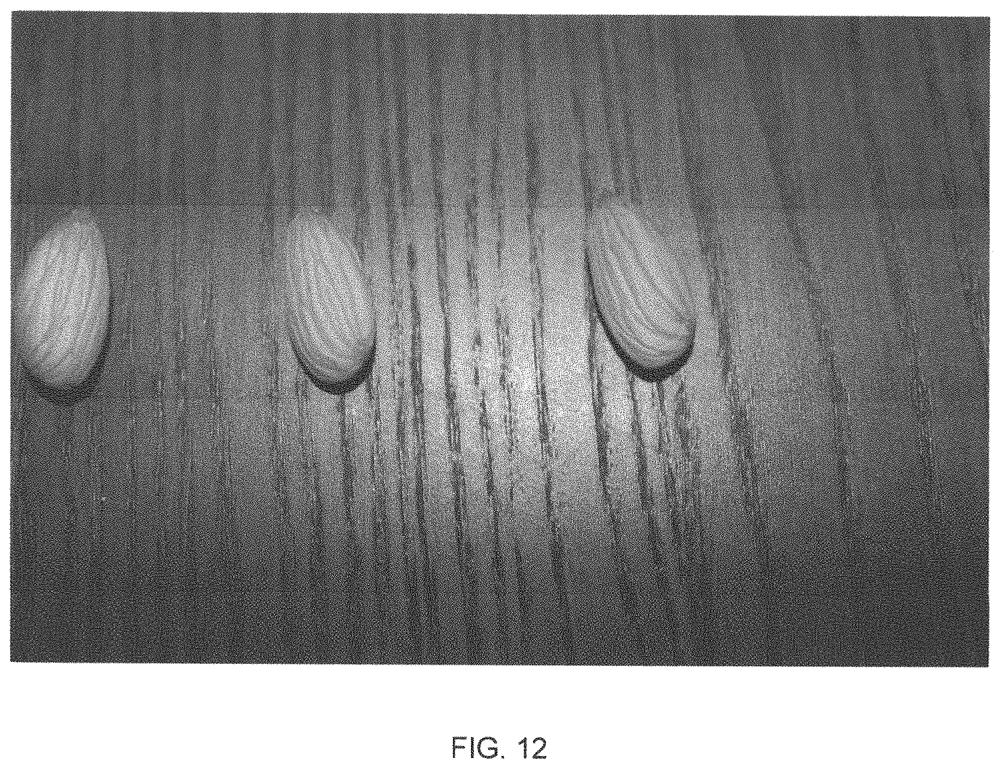 Patent USPP035421 Figure 12 – Almond tree named ‘PY1’