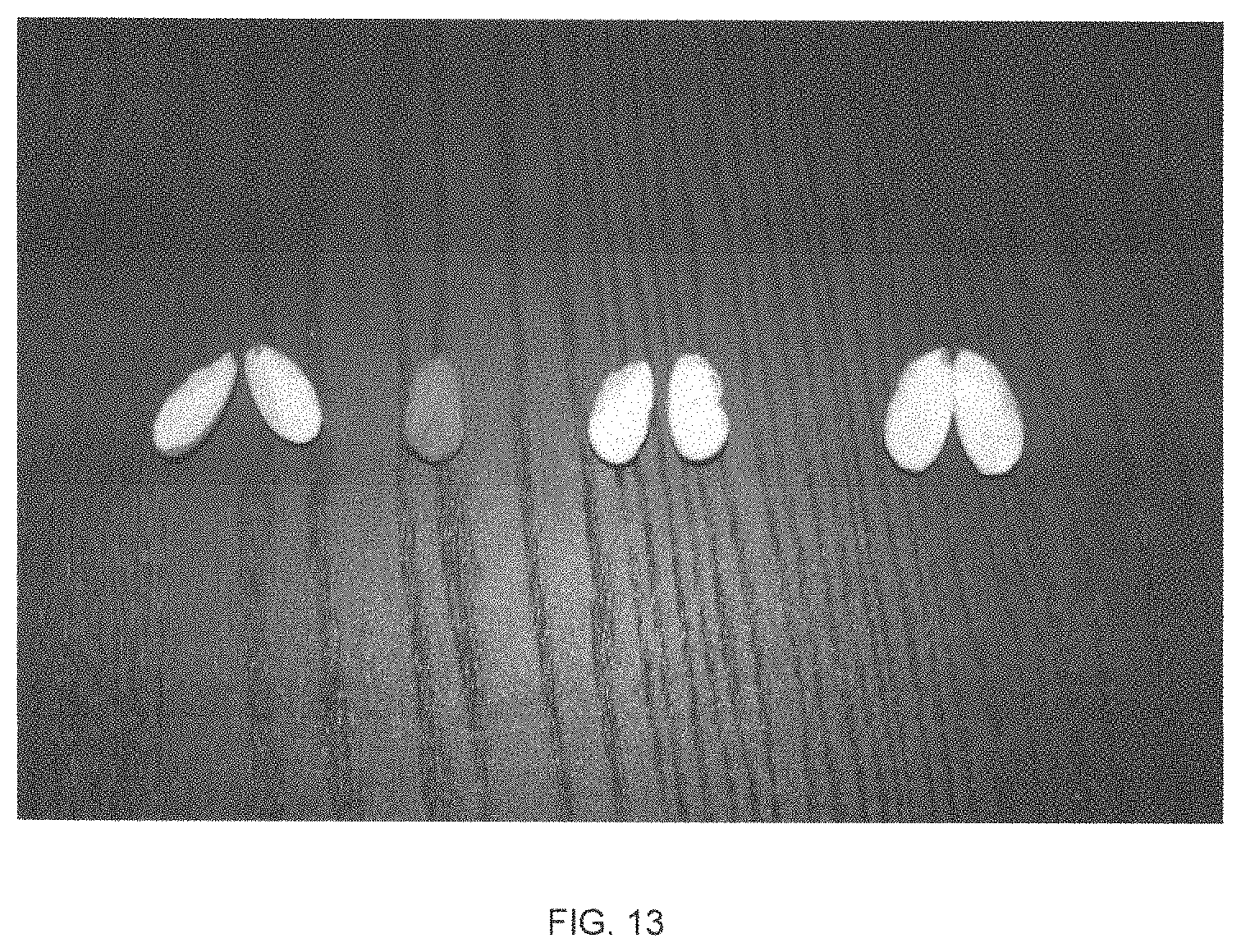 Patent USPP035421 Figure 13 – Almond tree named ‘PY1’