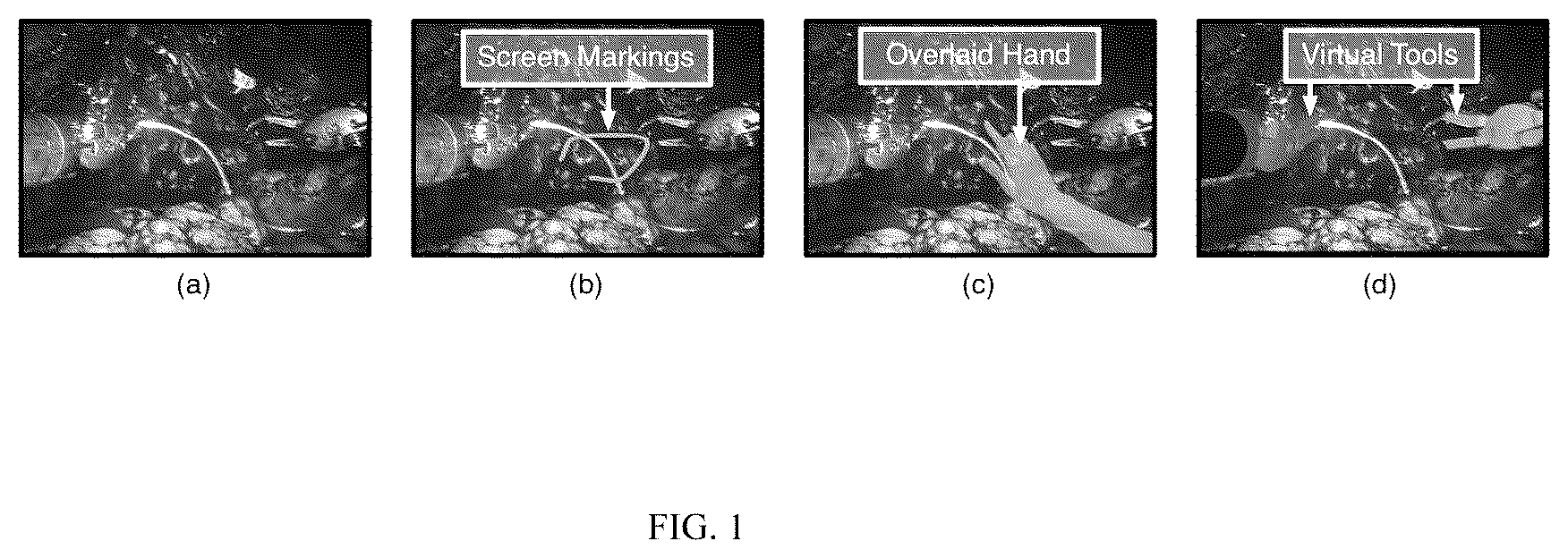Patent US12090002 Figure 1 – System and methods for tele-collaboration in minimally invasive surgeries