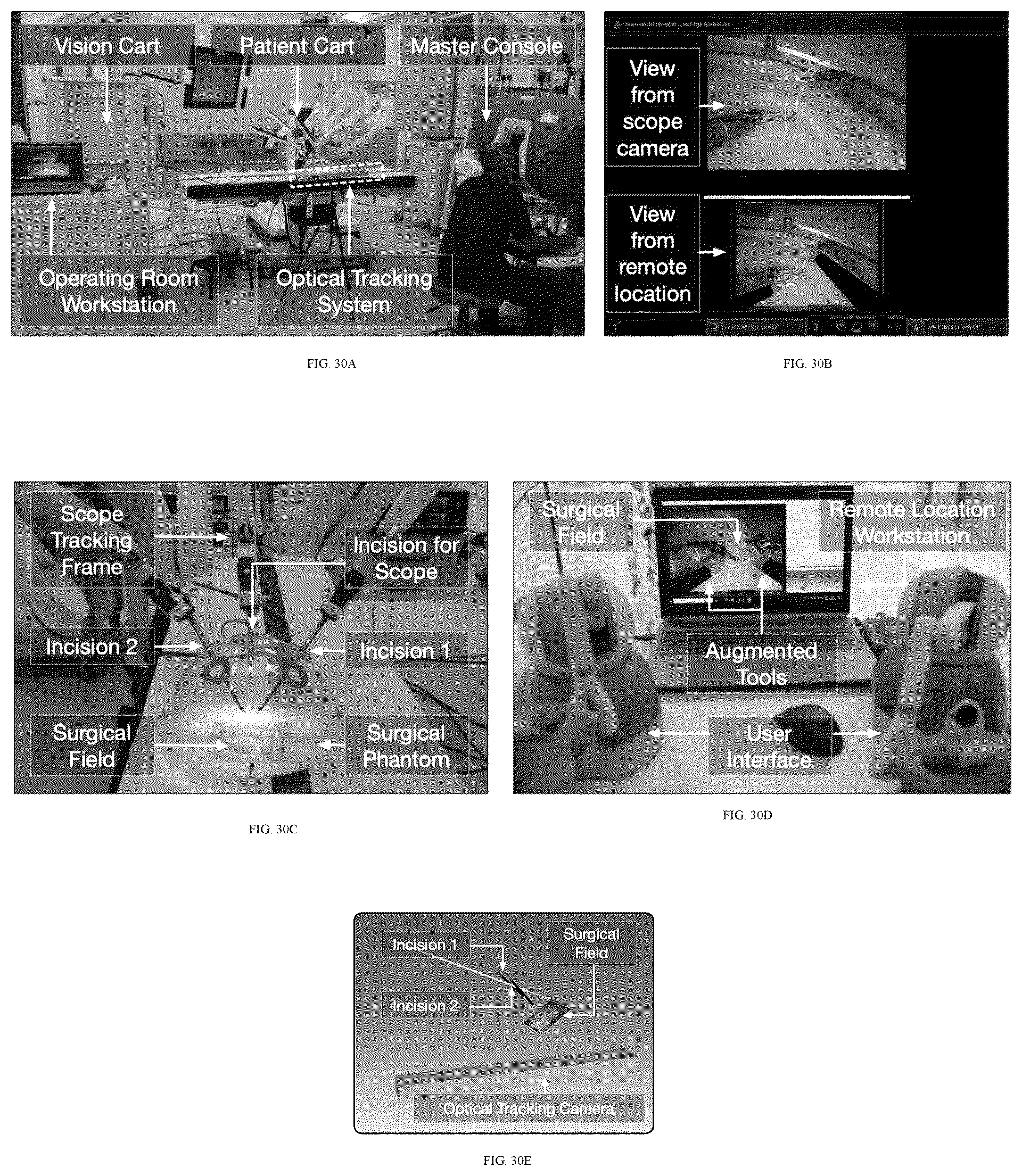 Patent US12090002 Figure 19 – System and methods for tele-collaboration in minimally invasive surgeries