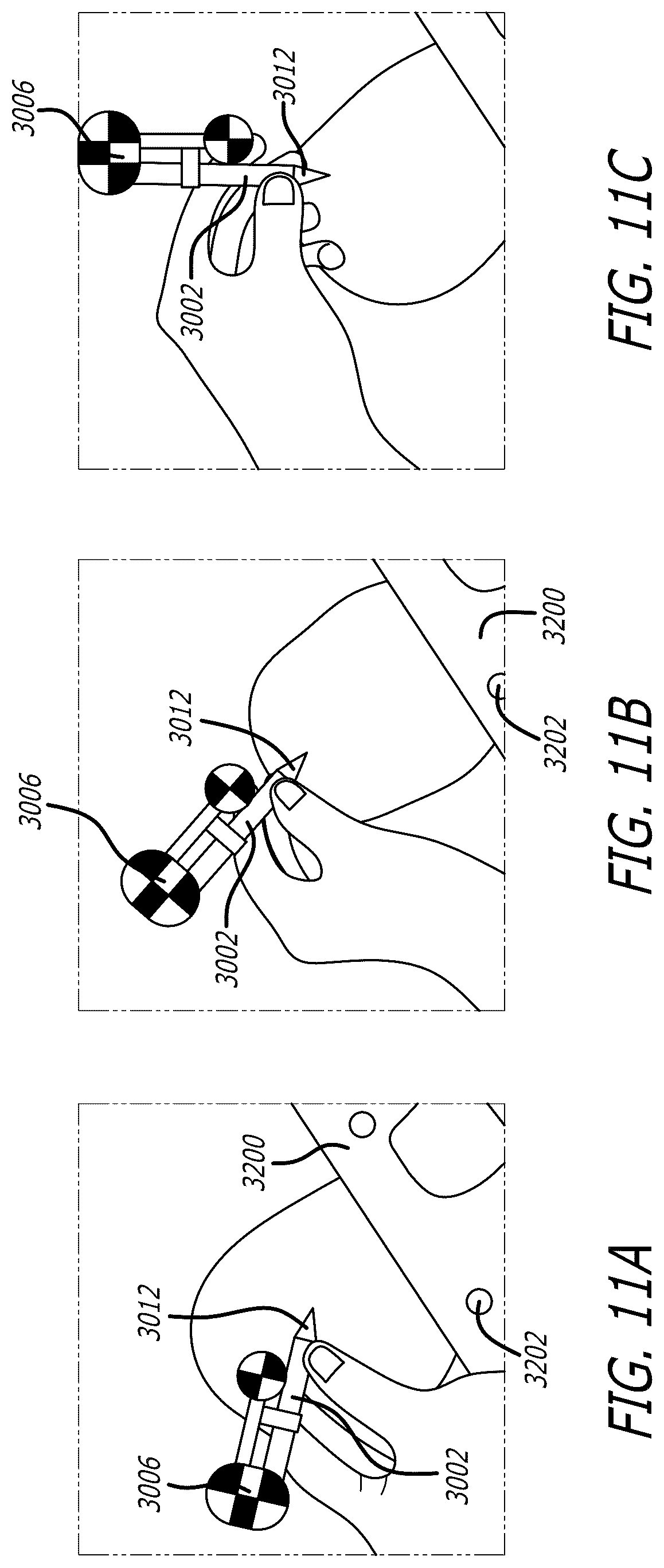 Patent US12090004 Figure 18 – Registration degradation correction for surgical navigation procedures