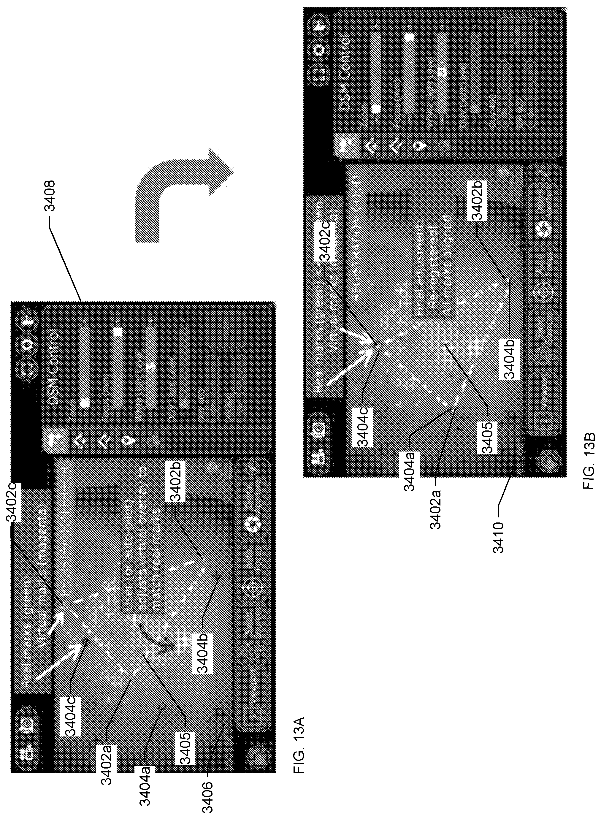 Patent US12090004 Figure 20 – Registration degradation correction for surgical navigation procedures