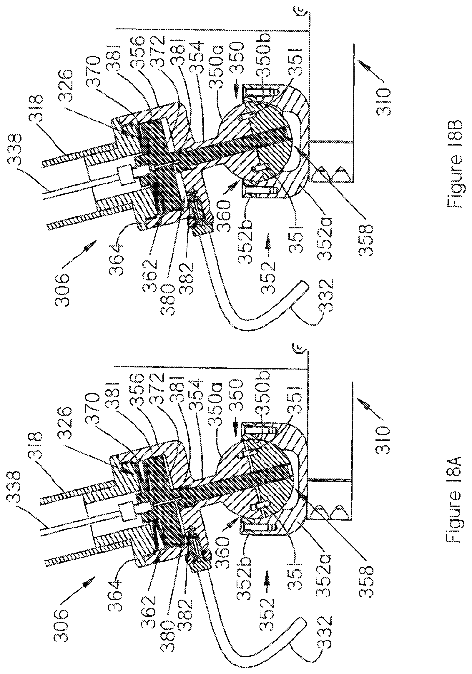 Patent US12090005 Figure 13 – Positioning apparatus for biomedical use