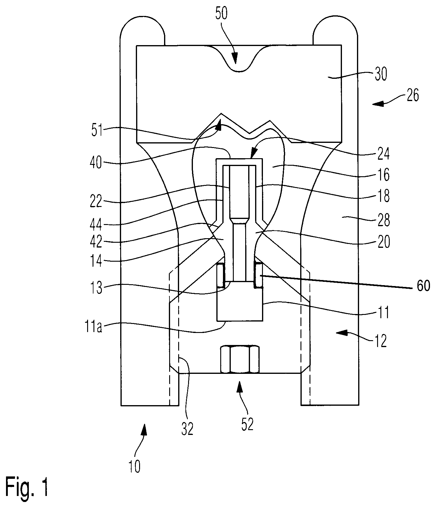 Patent US12090009 Figure 1 – Supra structure abutment holder as well as process for providing a bonding gap