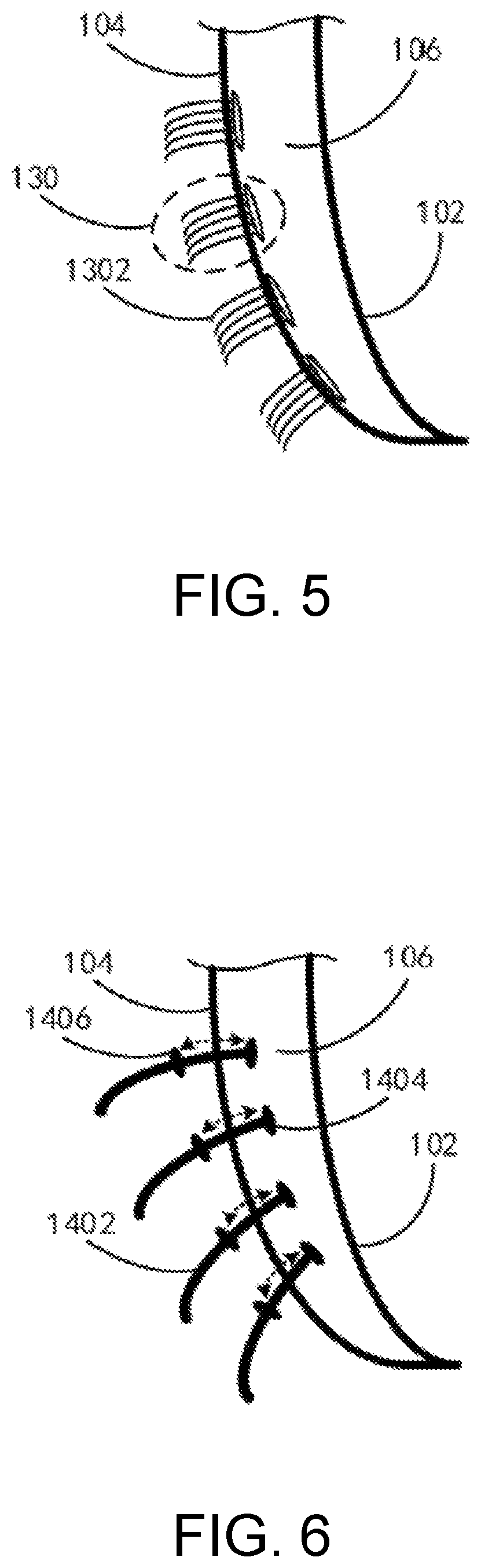 Patent US12090010 Figure 3 – Smart oral cleaner
