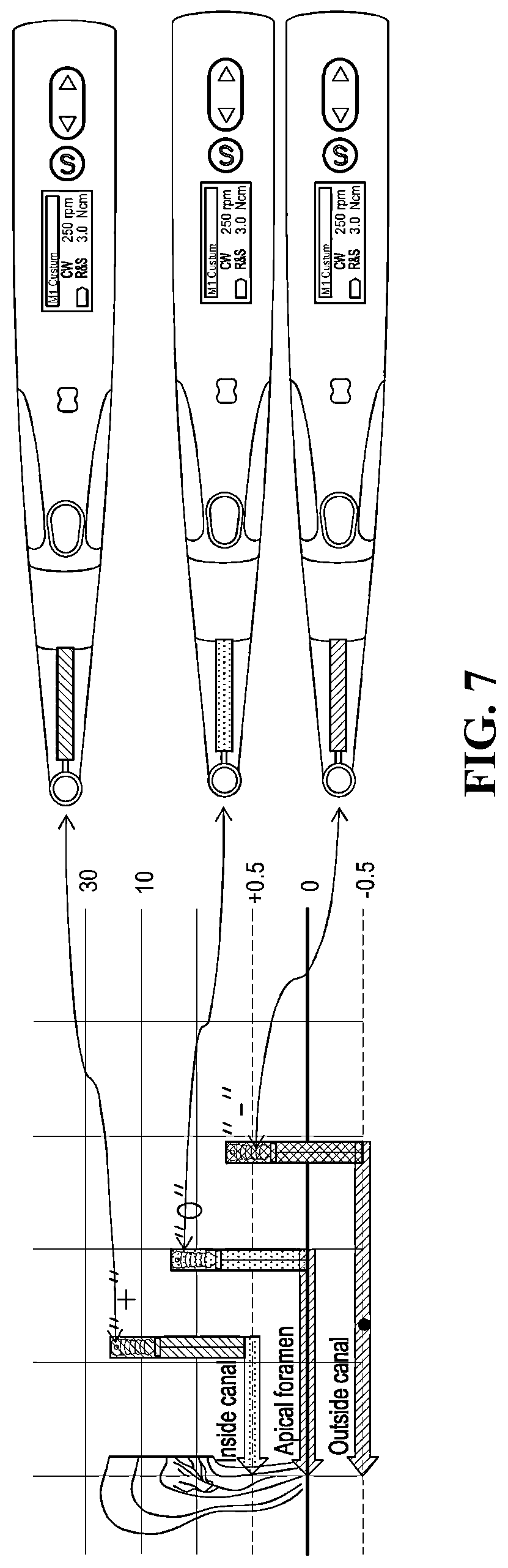 Patent US12090017 Figure 5 – Handpiece having root canal length measurement function