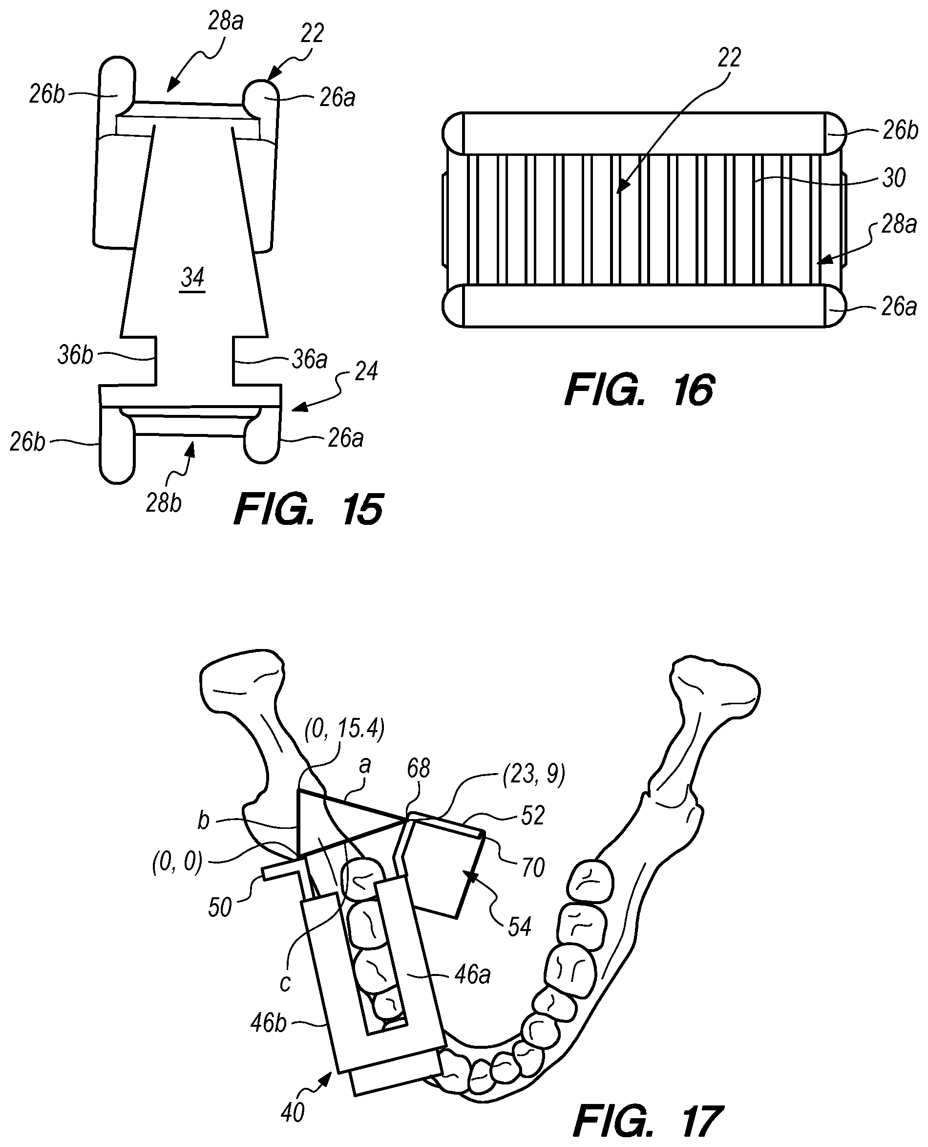 Patent US12090019 Figure 6 – Bite block with a needle alignment attachment system