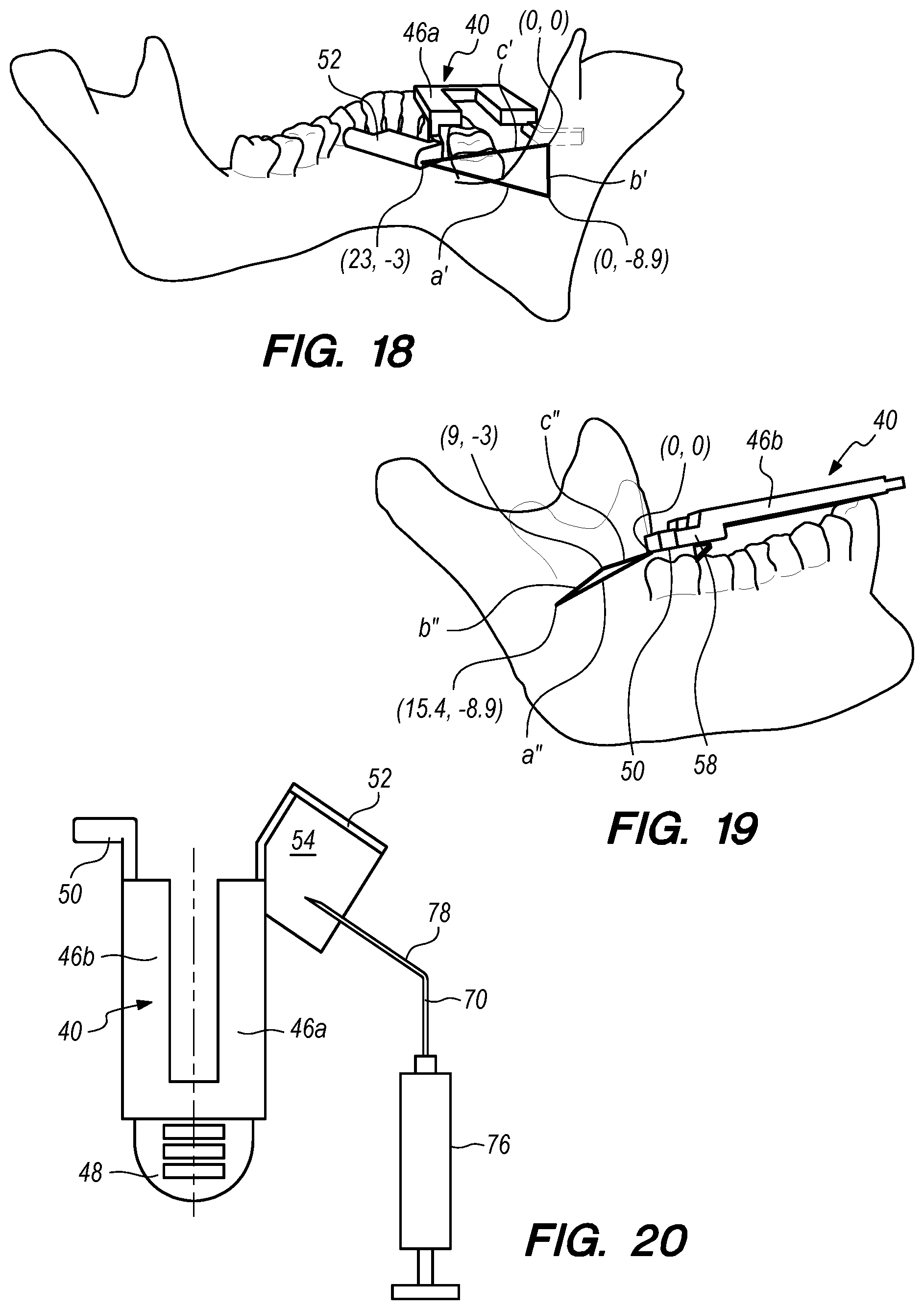 Patent US12090019 Figure 7 – Bite block with a needle alignment attachment system
