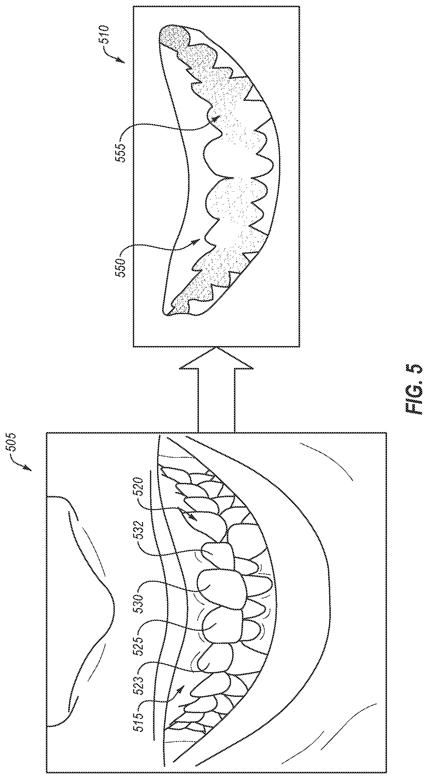 Patent US12090021 Figure 5 – Smile prediction