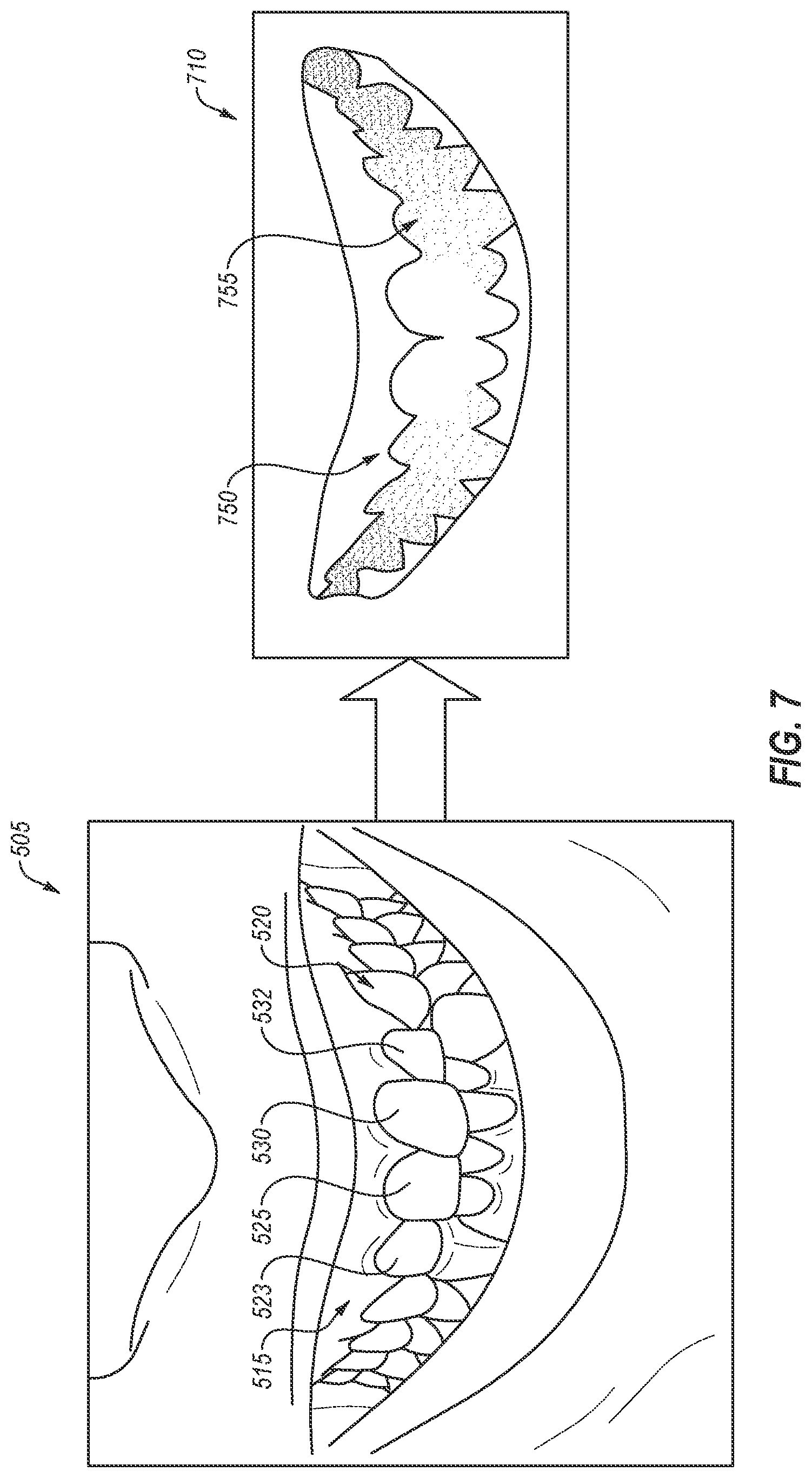 Patent US12090021 Figure 7 – Smile prediction