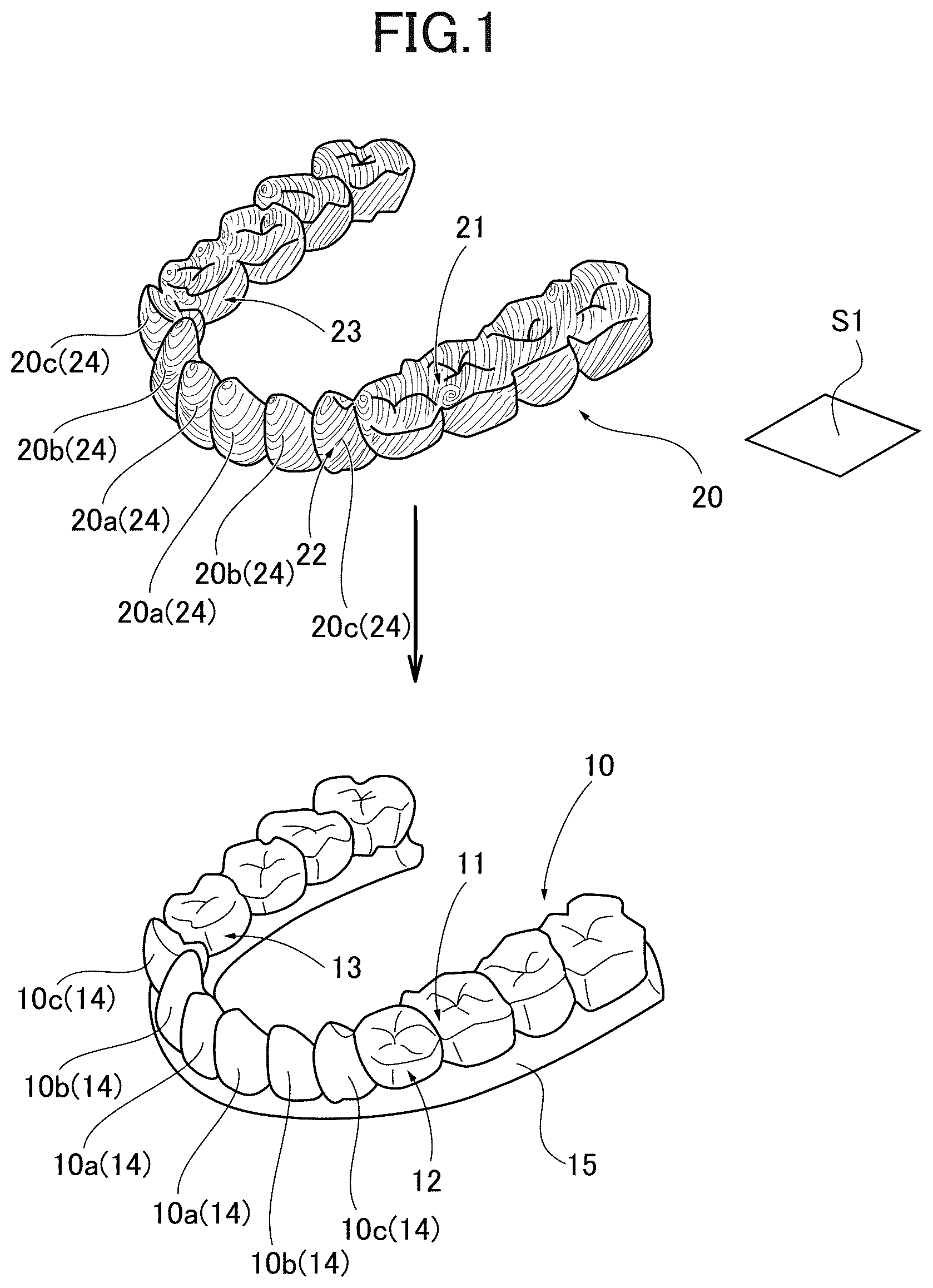 Patent US12090022 Figure 1 – Mouthpiece and mouthpiece manufacturing method