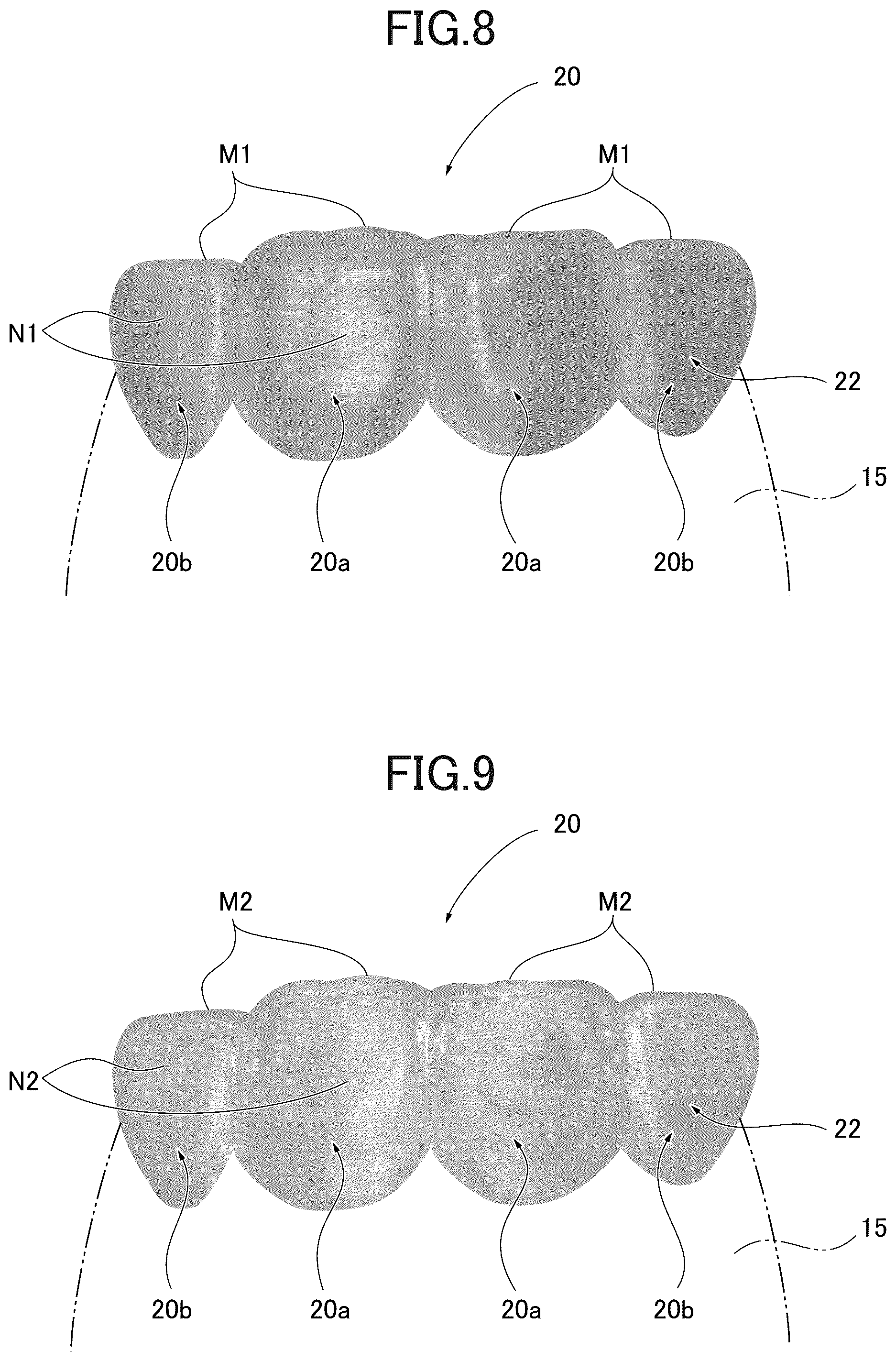 Patent US12090022 Figure 7 – Mouthpiece and mouthpiece manufacturing method