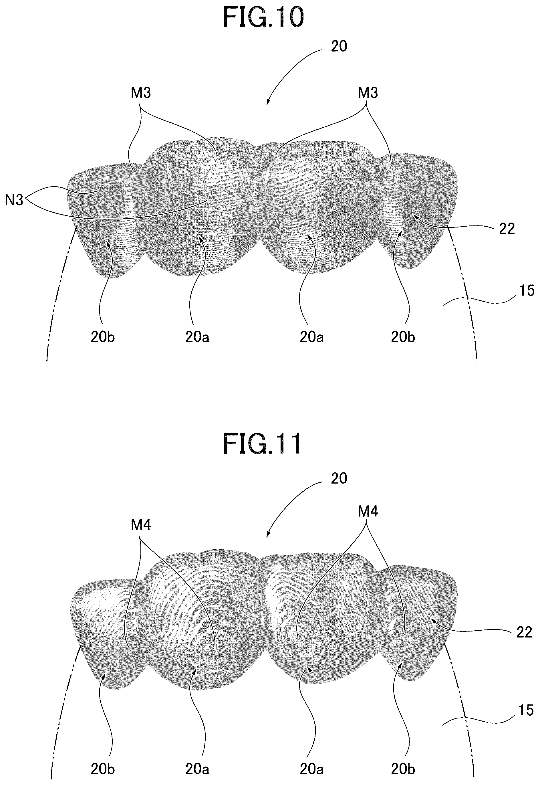 Patent US12090022 Figure 8 – Mouthpiece and mouthpiece manufacturing method