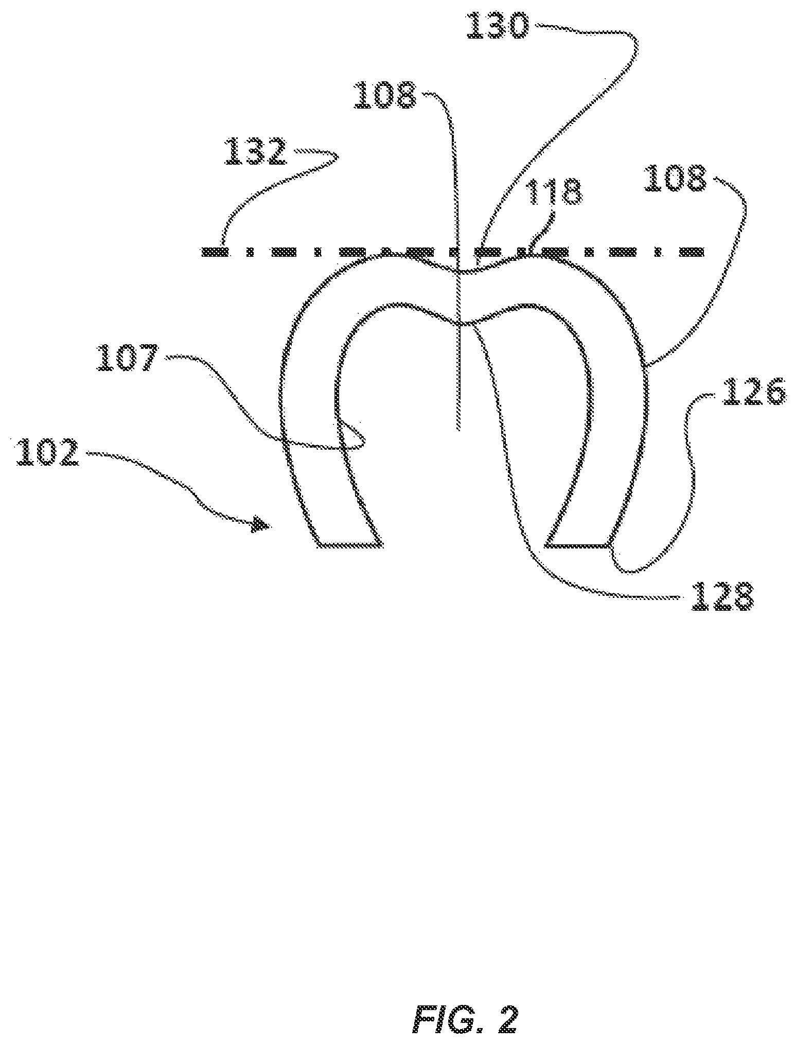 Patent US12090023 Figure 2 – Aligner material, cleanliness, and quality detection via aligner case