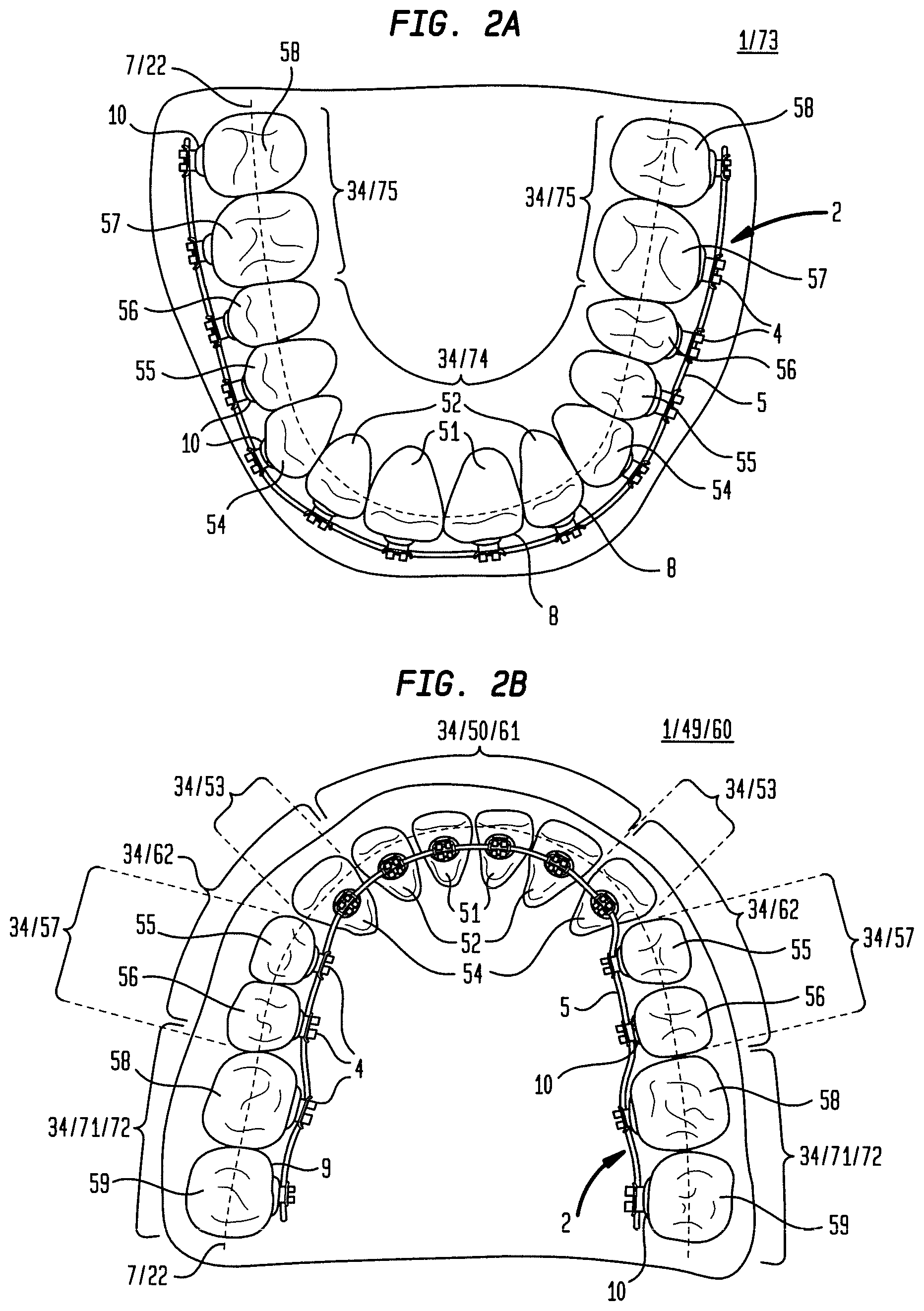 Patent US12090024 Figure 2 – Bracket system