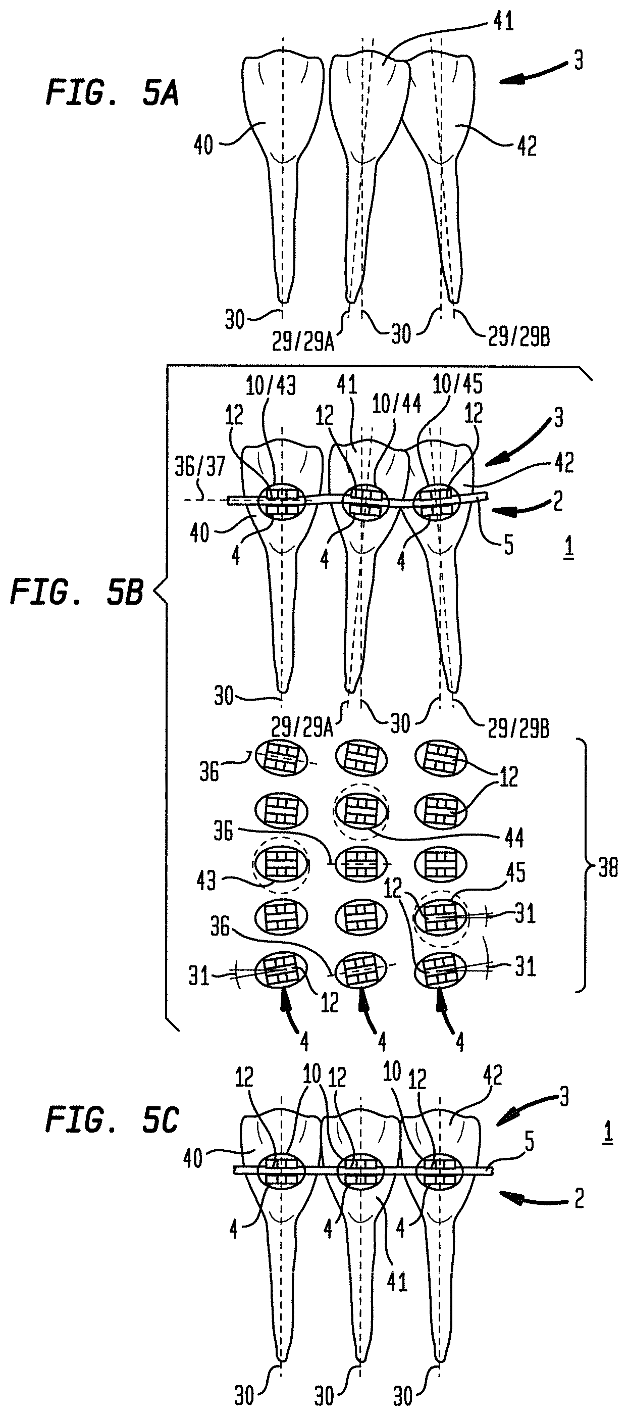 Patent US12090024 Figure 5 – Bracket system