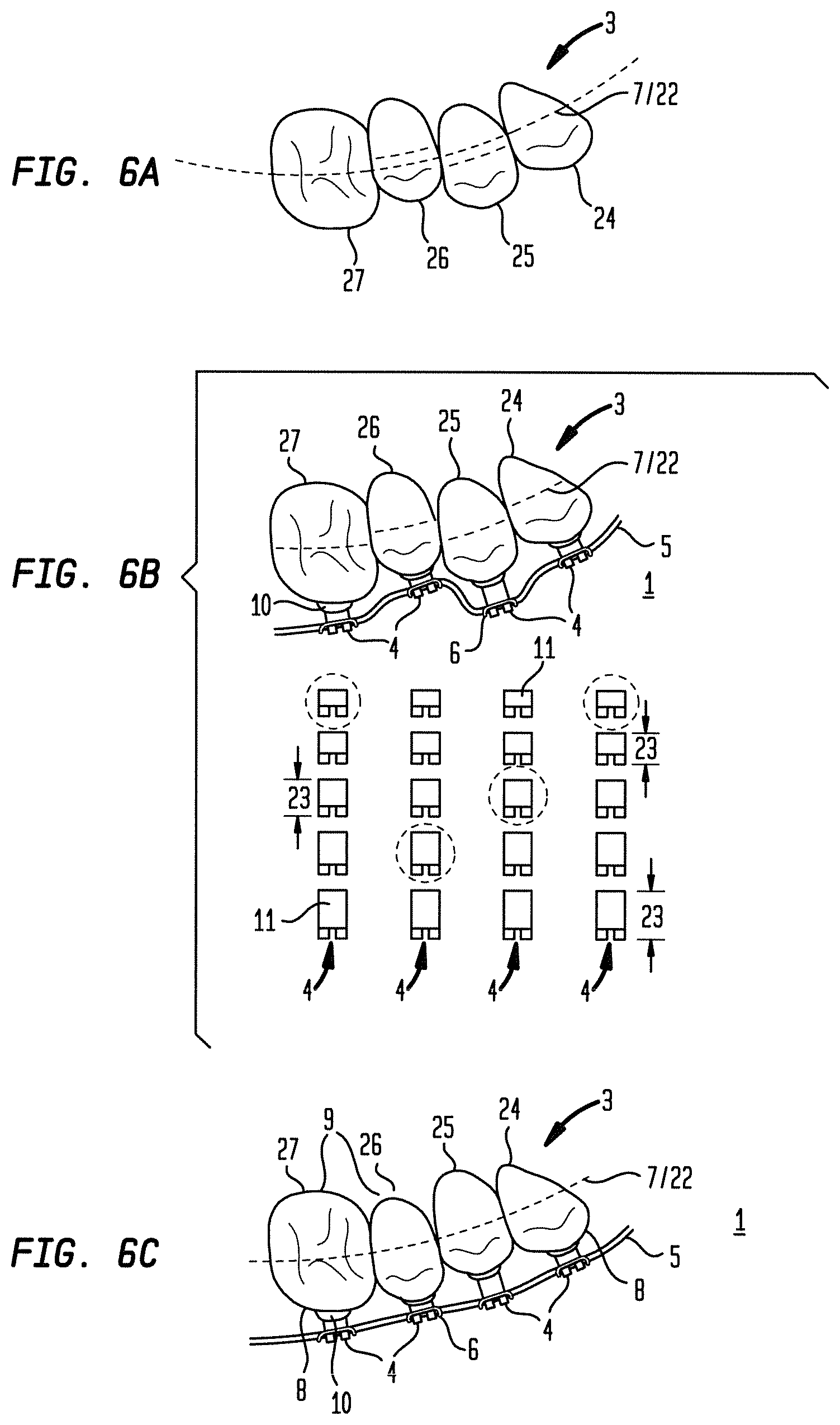 Patent US12090024 Figure 6 – Bracket system