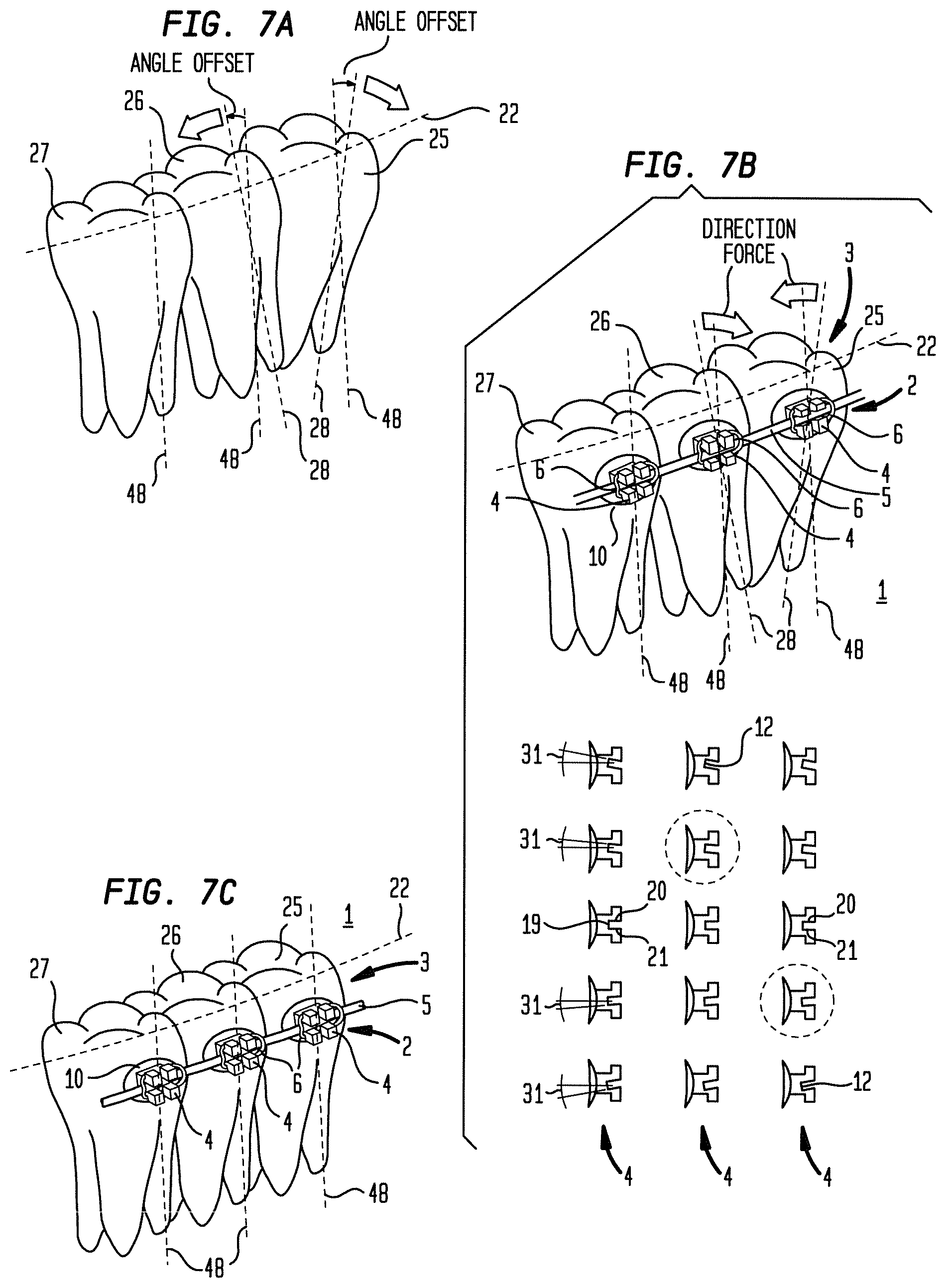 Patent US12090024 Figure 7 – Bracket system
