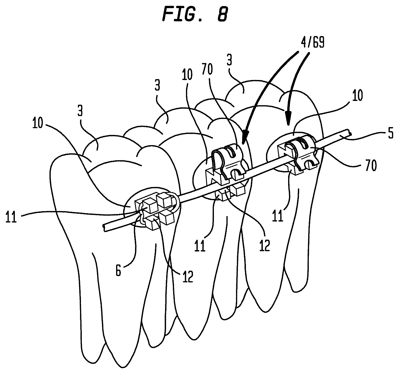 Patent US12090024 Figure 9 – Bracket system