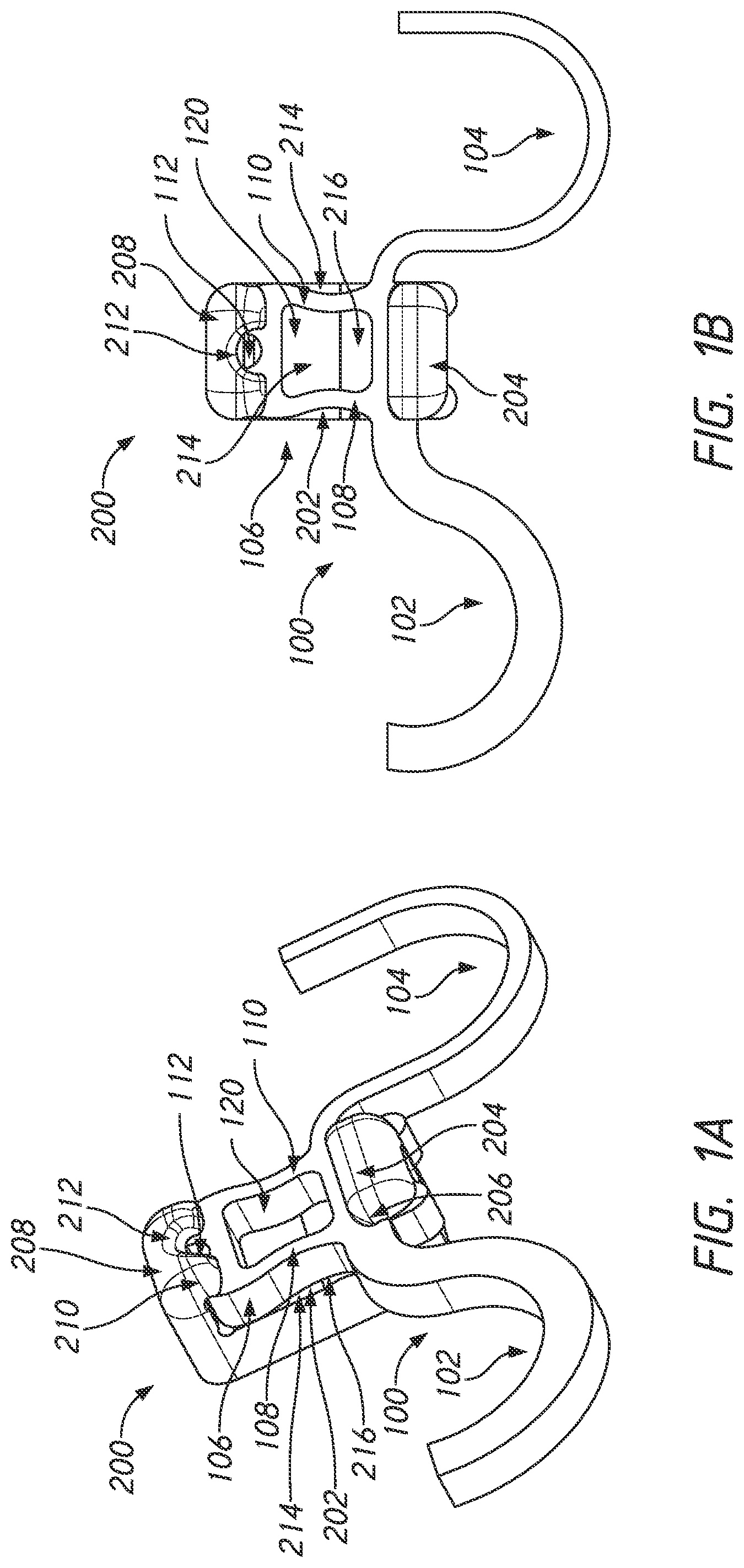 Patent US12090025 Figure 1 – Orthodontic appliance with non-sliding archform