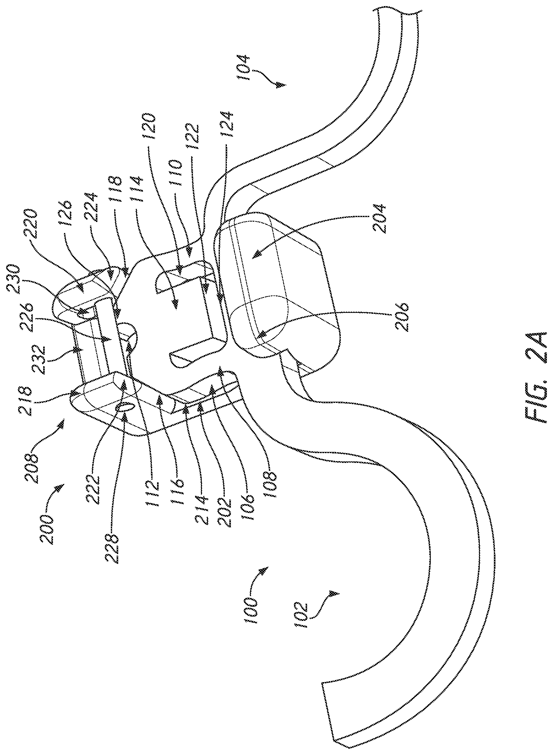 Patent US12090025 Figure 2 – Orthodontic appliance with non-sliding archform