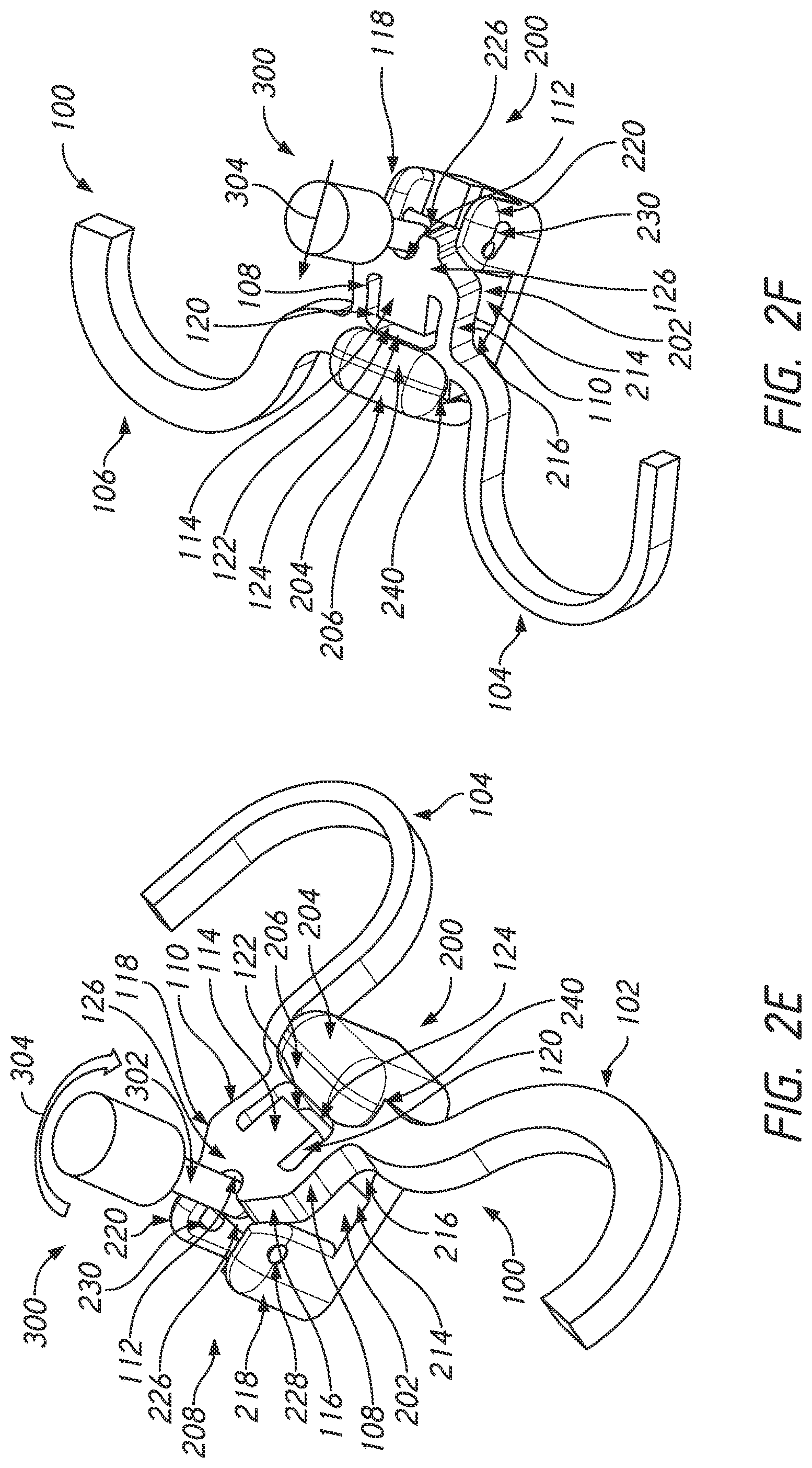 Patent US12090025 Figure 5 – Orthodontic appliance with non-sliding archform