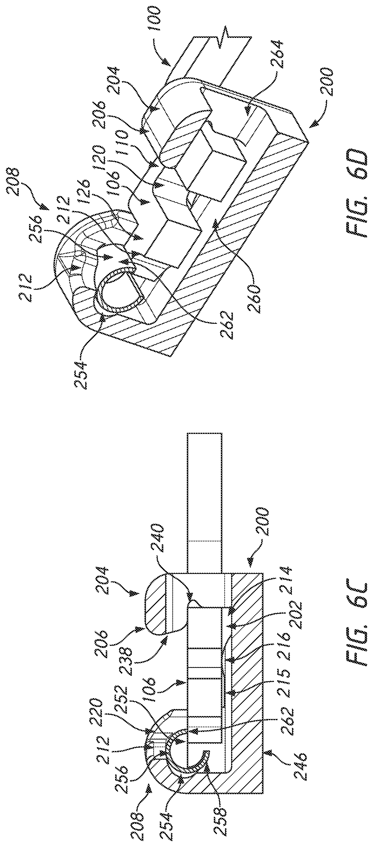 Patent US12090025 Figure 12 – Orthodontic appliance with non-sliding archform
