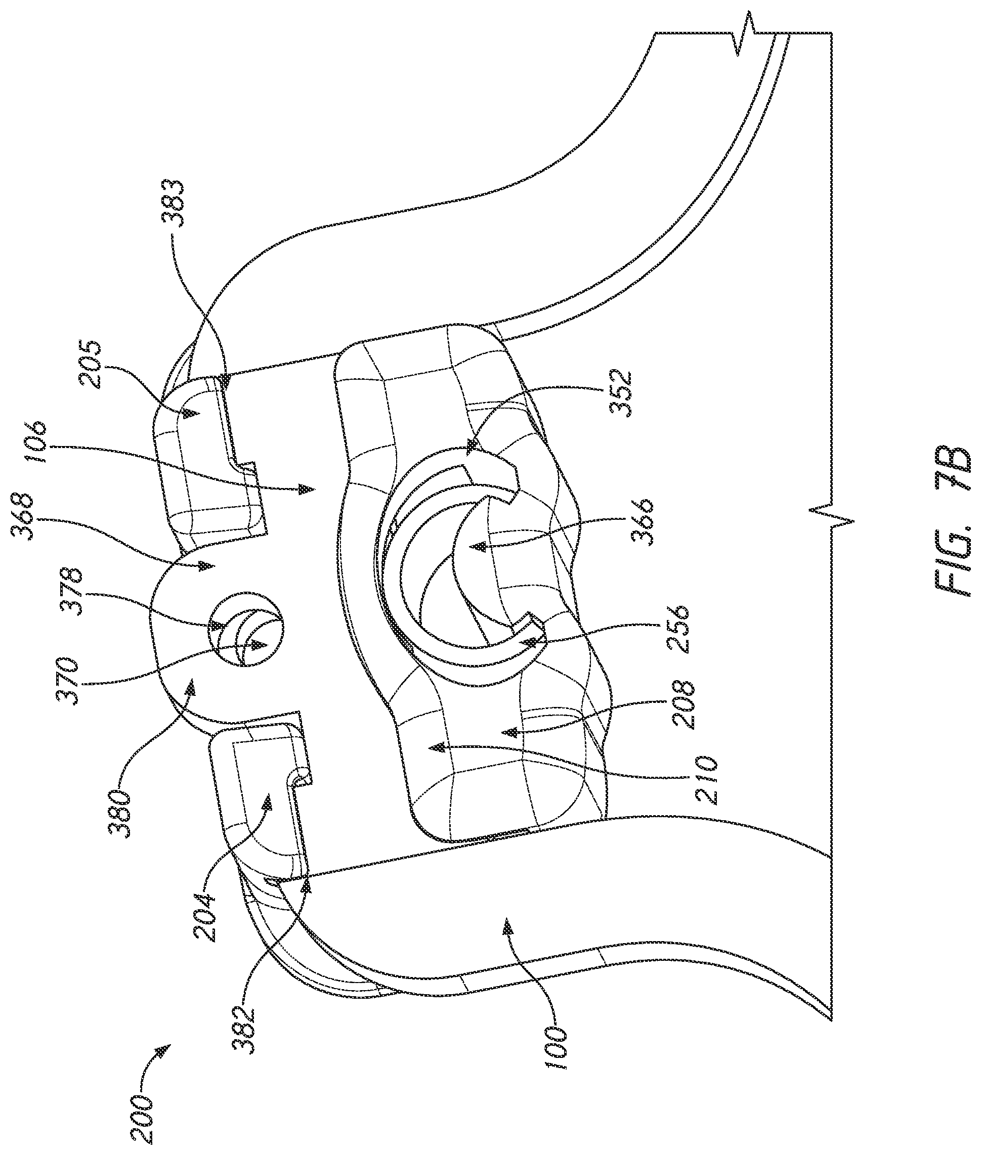 Patent US12090025 Figure 15 – Orthodontic appliance with non-sliding archform